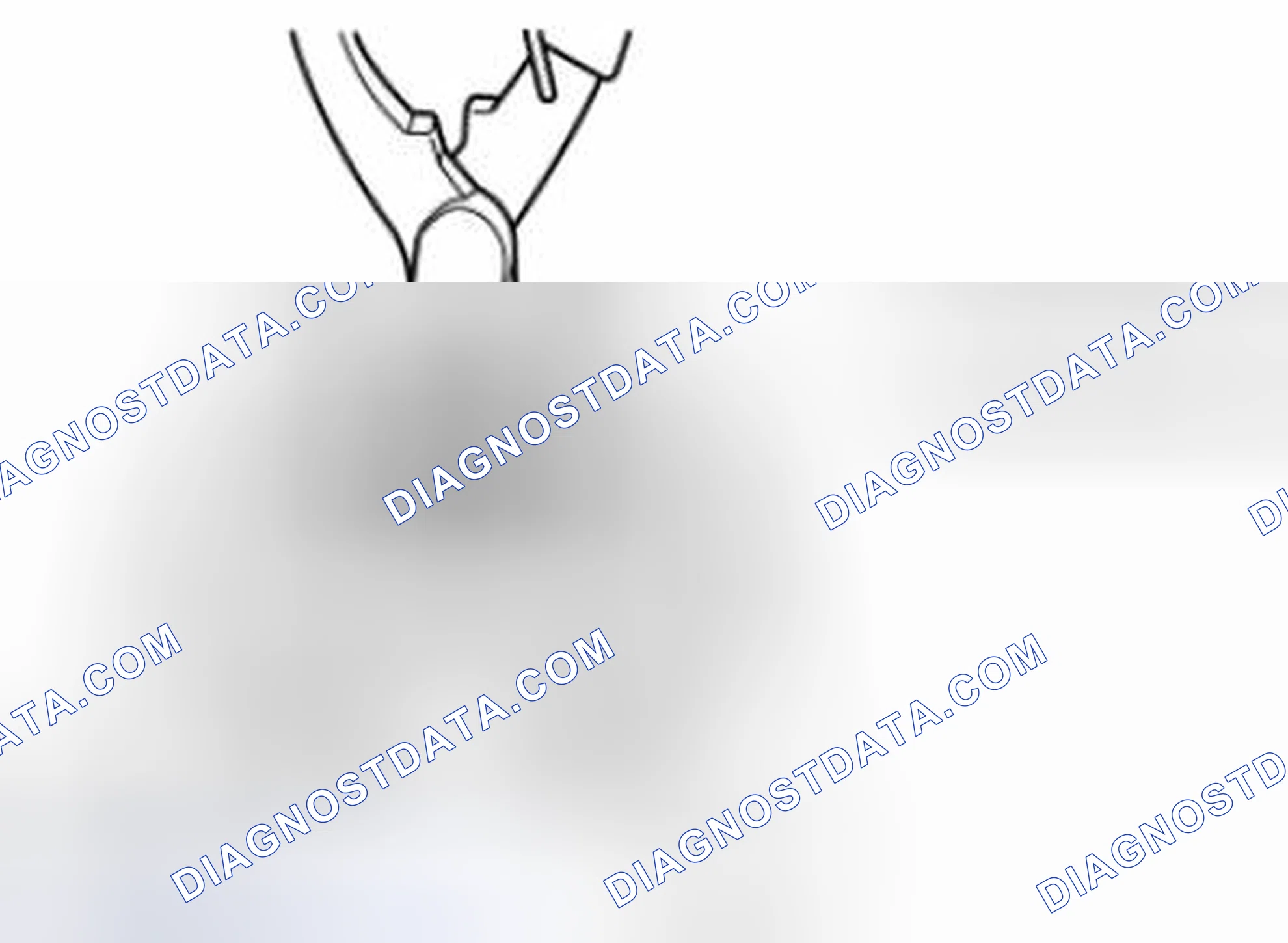 Scheme 47: Snap Ring Removal/Installation Note