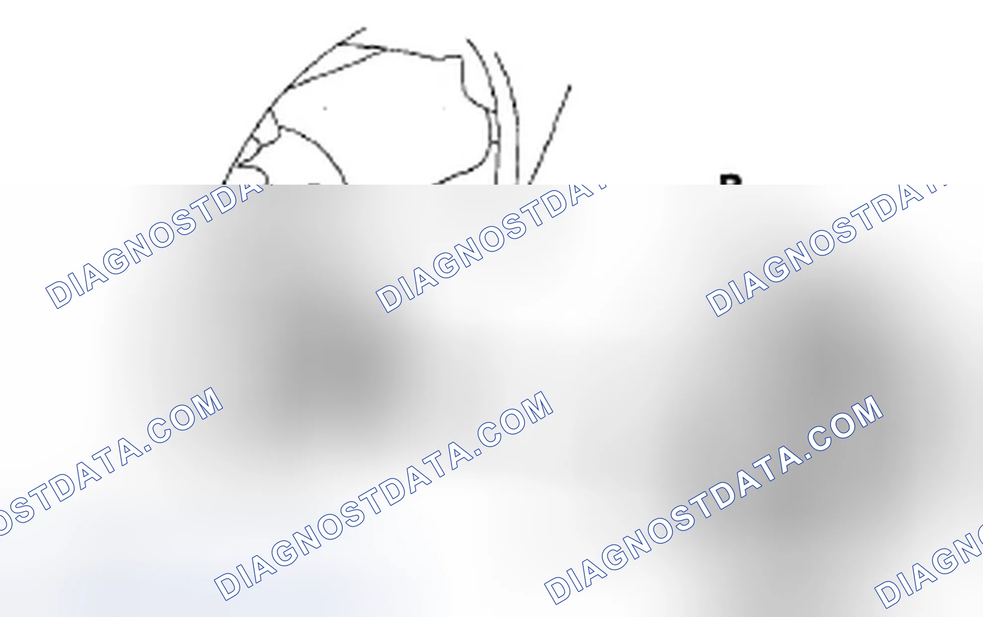 Scheme 75: Differential Removal