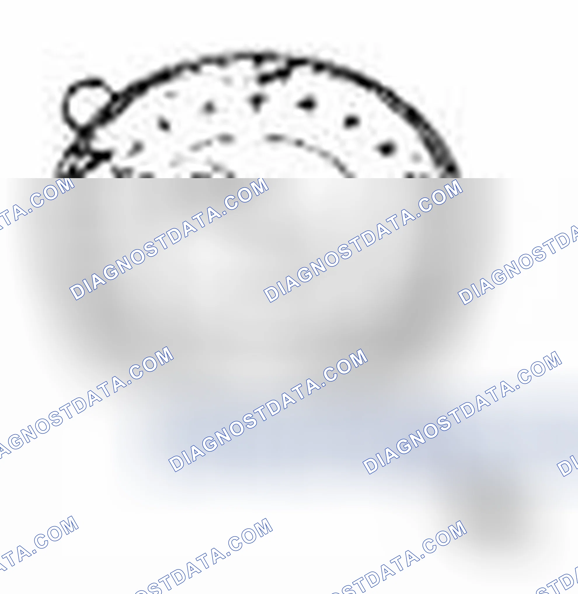 Scheme 51: Special Tool