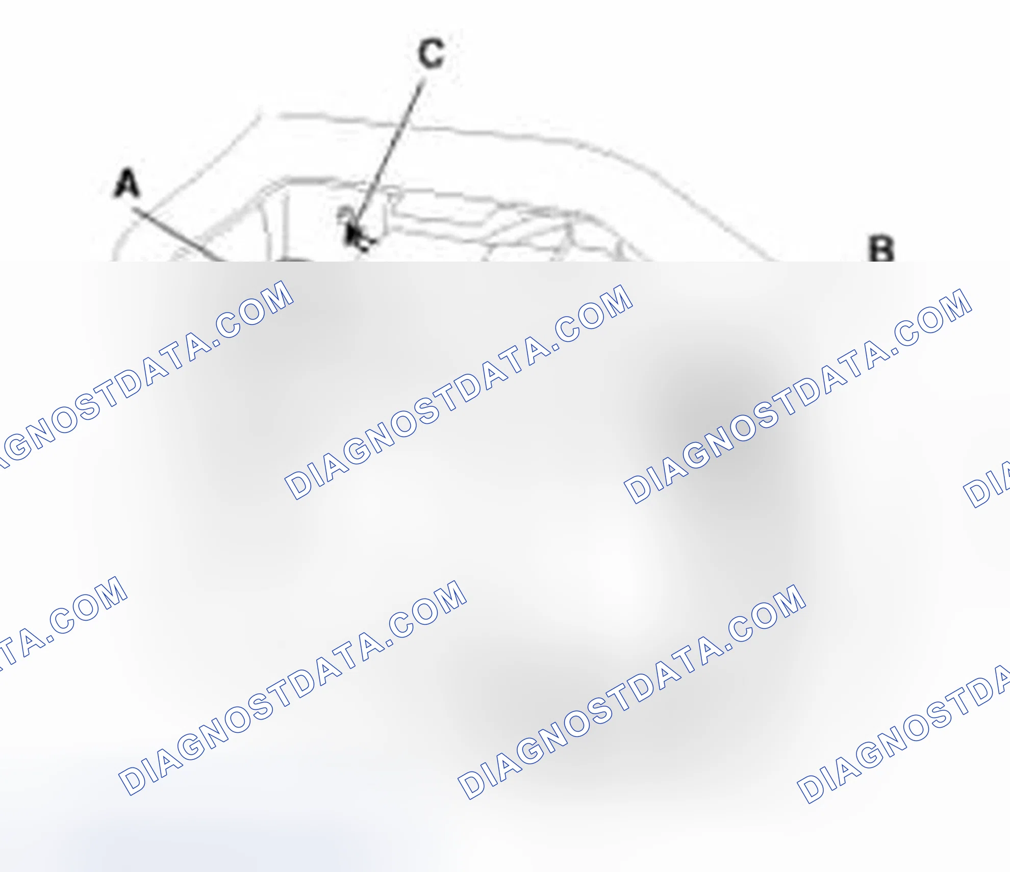Scheme 185: Removal and Installation