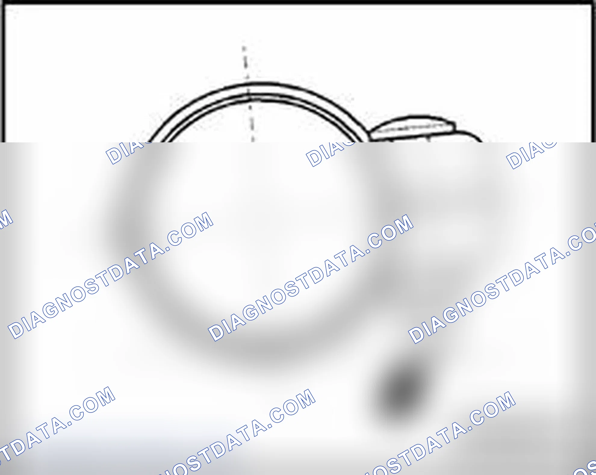 Scheme 325: Installed position of front clamp