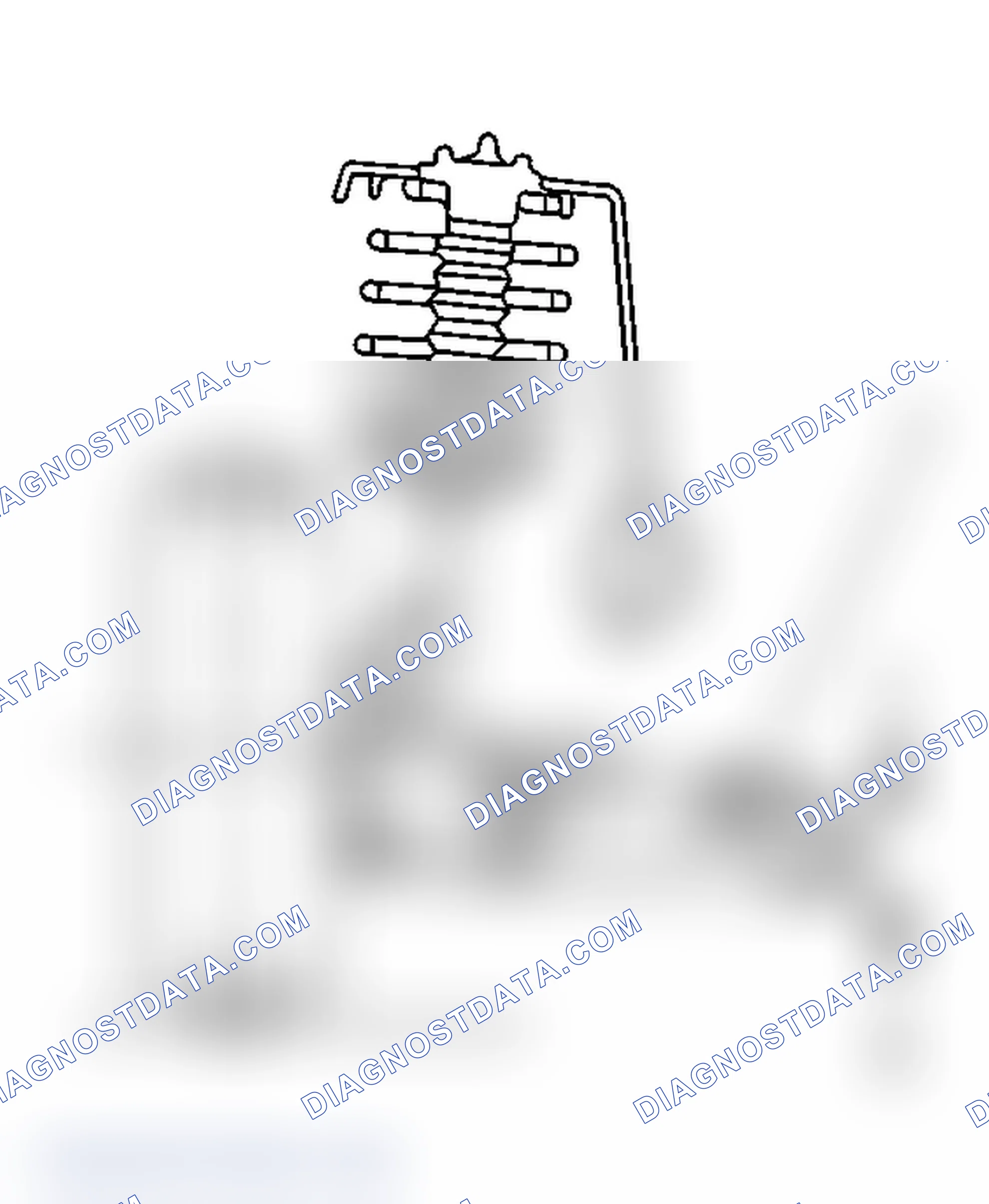Scheme 10: Measuring the Z Dimension (Front Suspension)