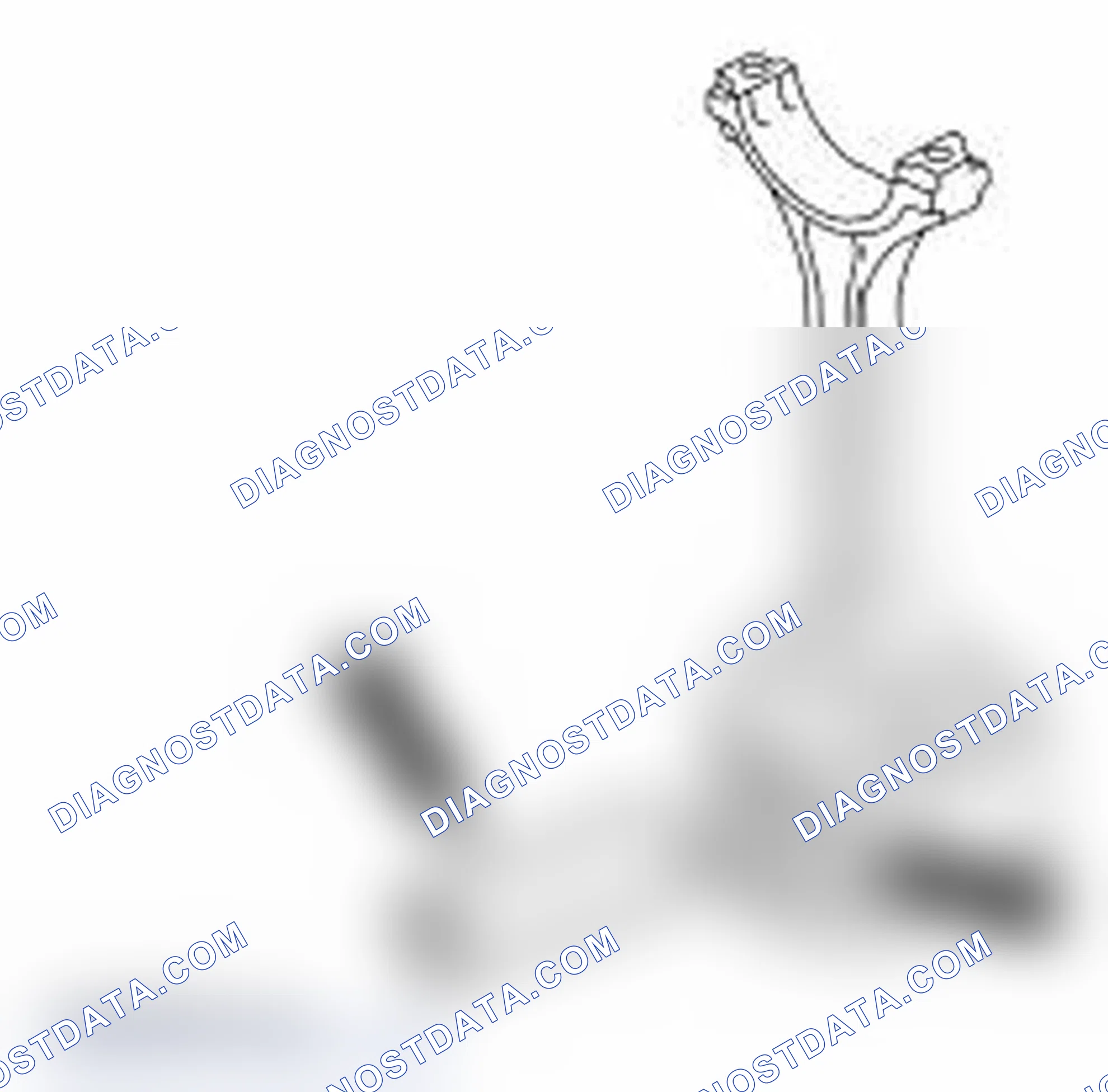 Scheme 230: Assembly