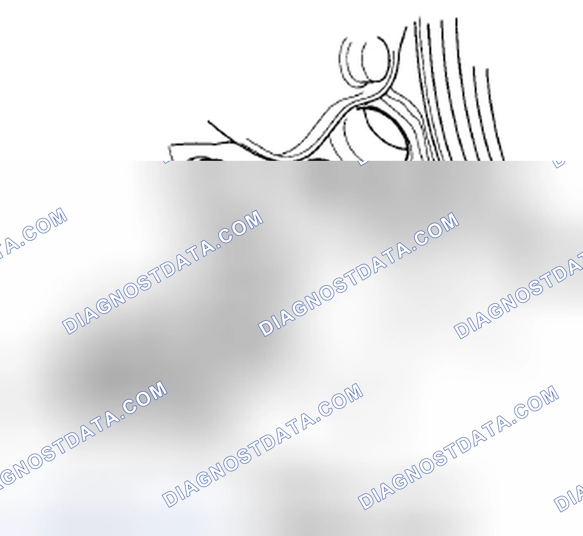 Scheme 699: CKP Sensor Replacement