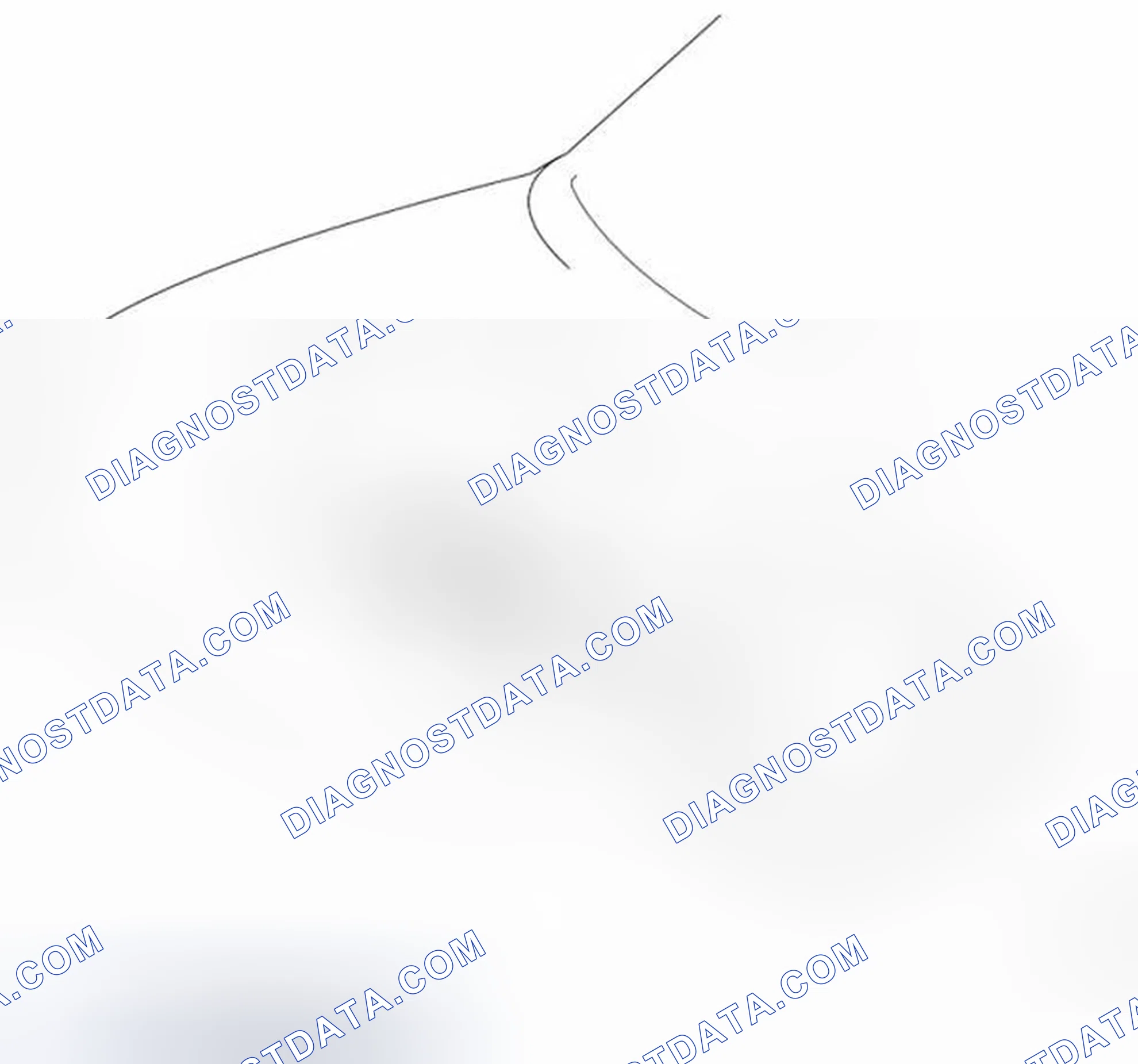 Scheme 69: Engine Mounting