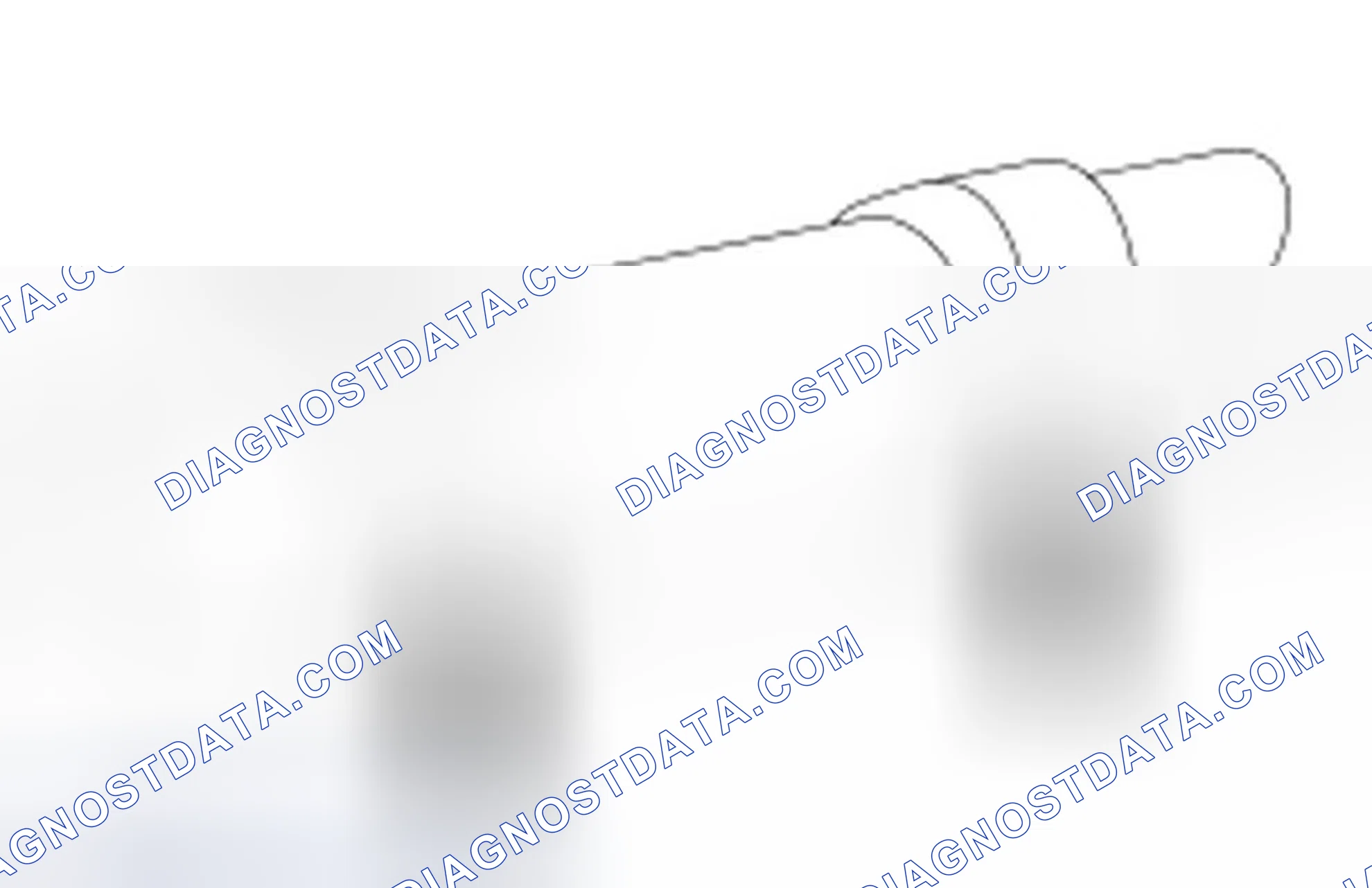 Scheme 375: Inspecting Camshaft Lobes