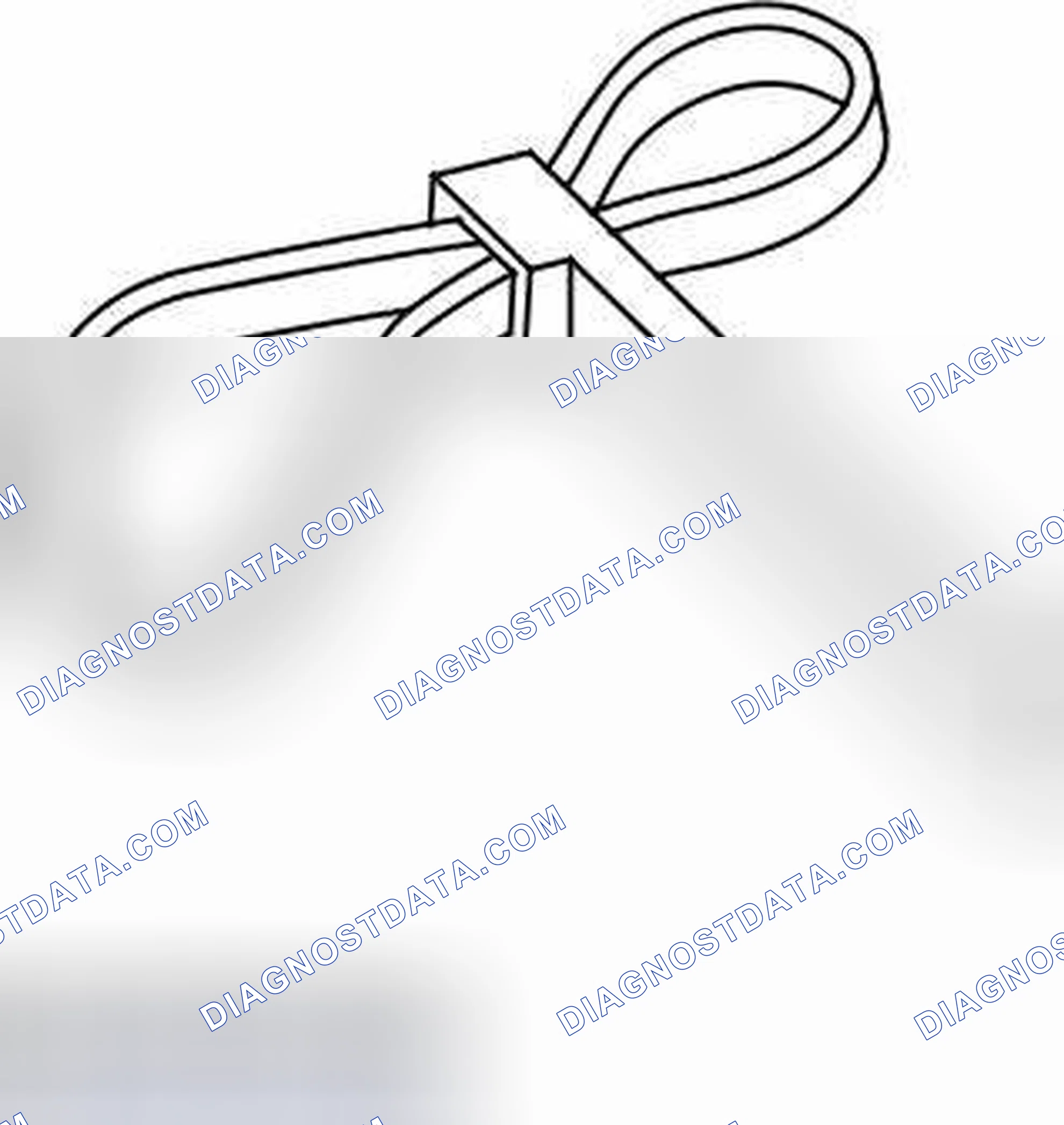Scheme 296: Crankshaft Pulley - In-Vehicle Procedures