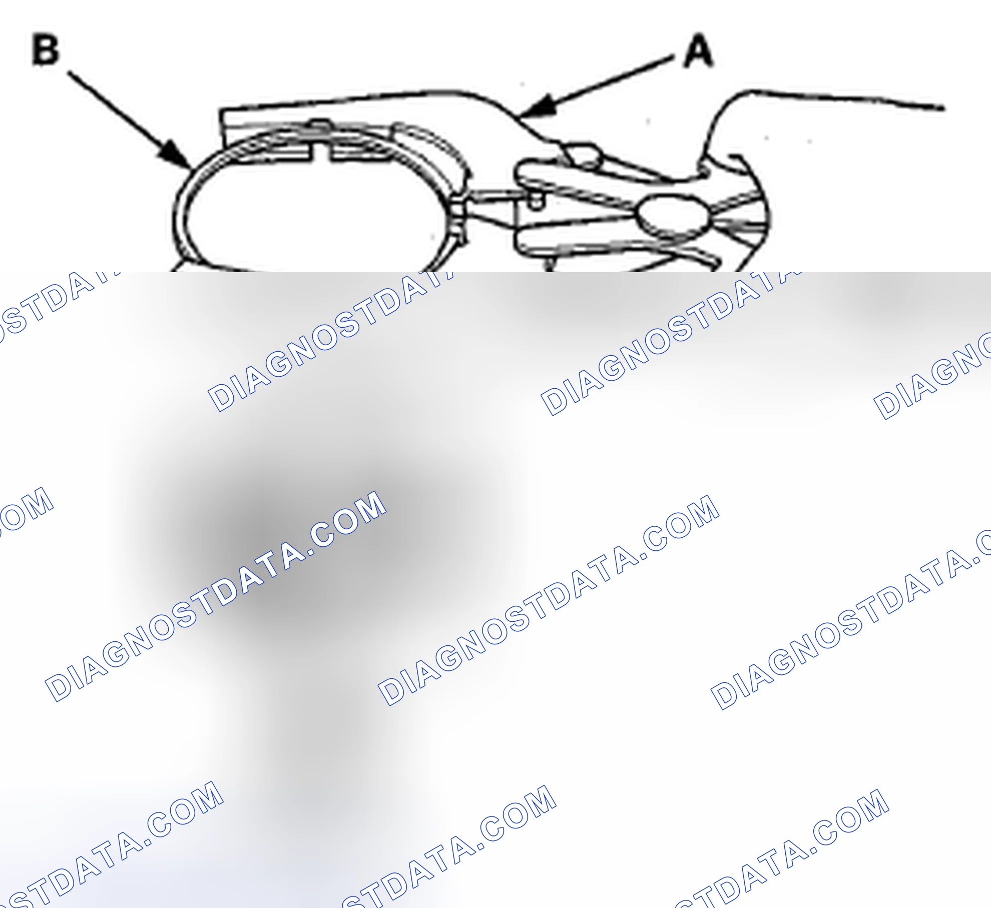 Scheme 296: Piston Ring Replacement