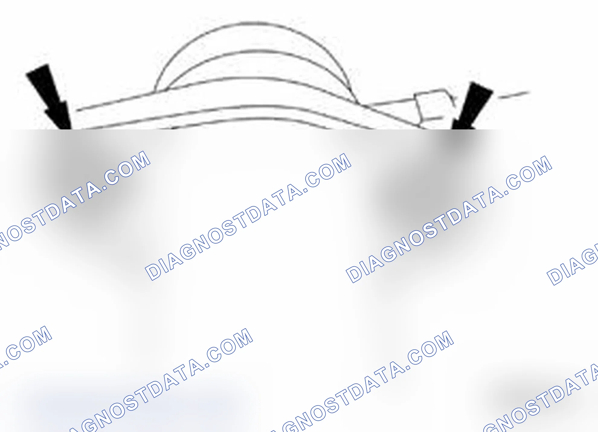 Scheme 1060: Removal