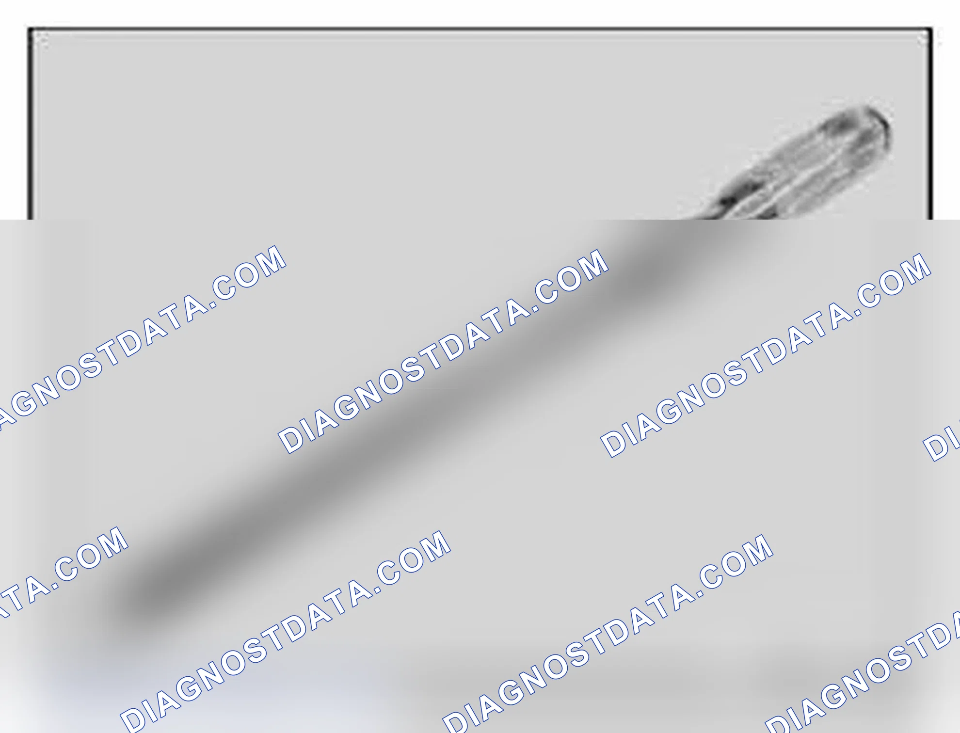 Scheme 86: 32 1 030 Lever