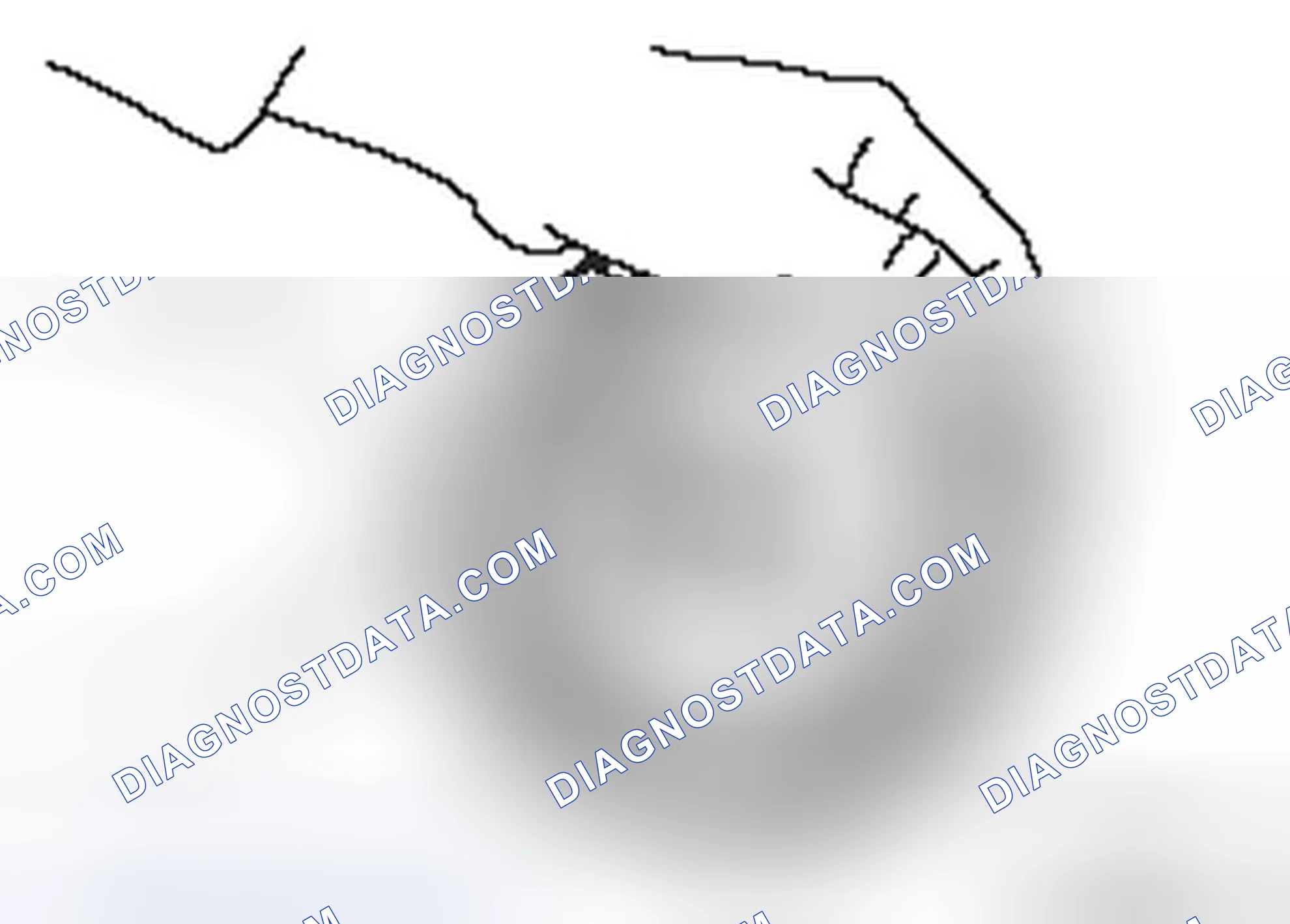 Scheme 103: << C >> SNAP RING REMOVAL