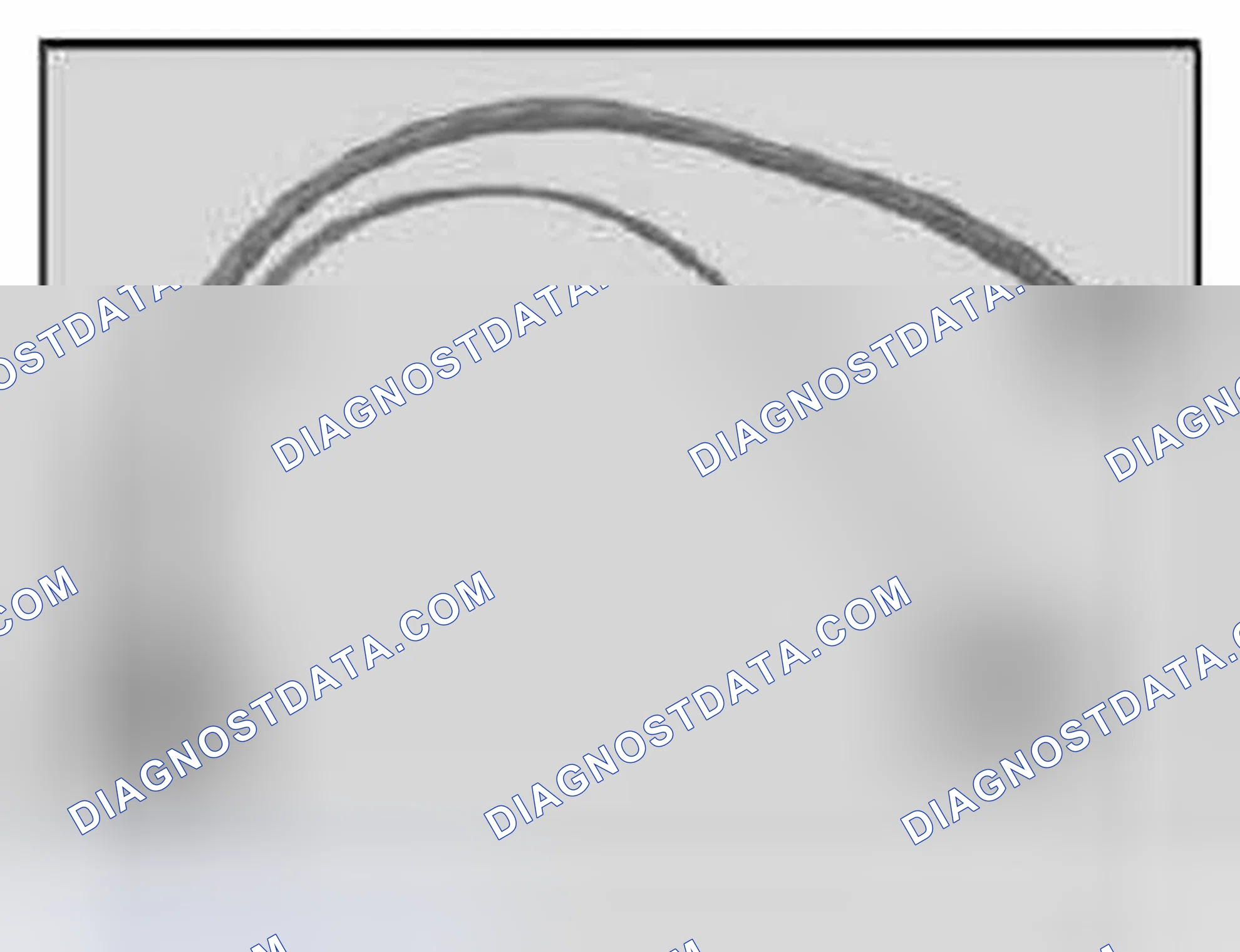 Scheme 228: 61 3 090 V-Adapter Lead DXC Control Unit E83 (6 -pin)