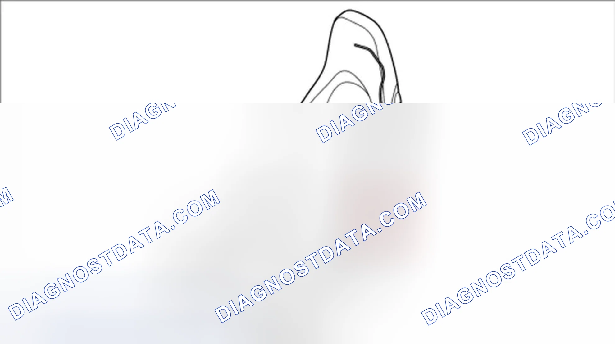 Scheme 148: Removing support for left backrest side part