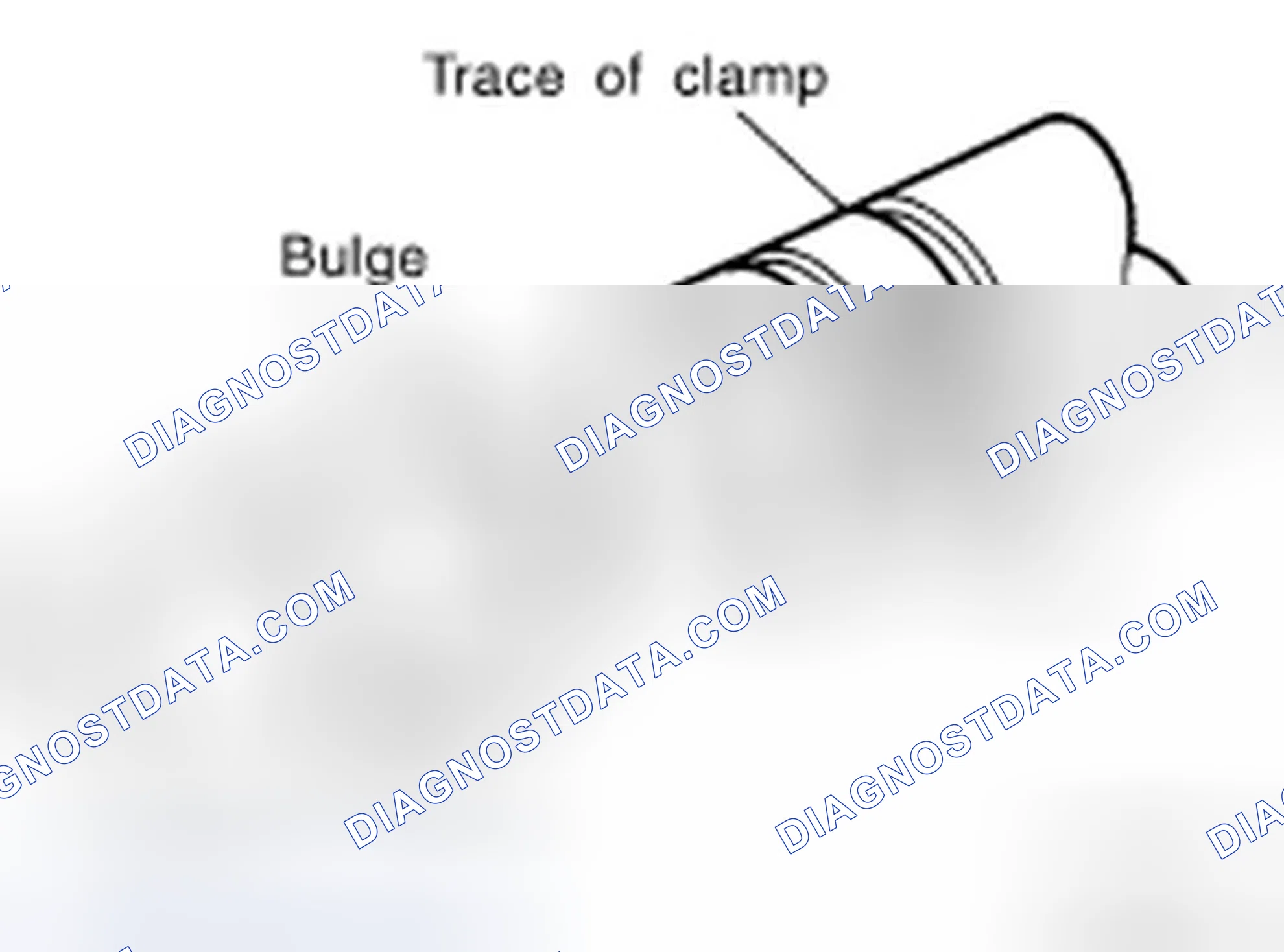 Scheme 38: HOSE CLAMPING