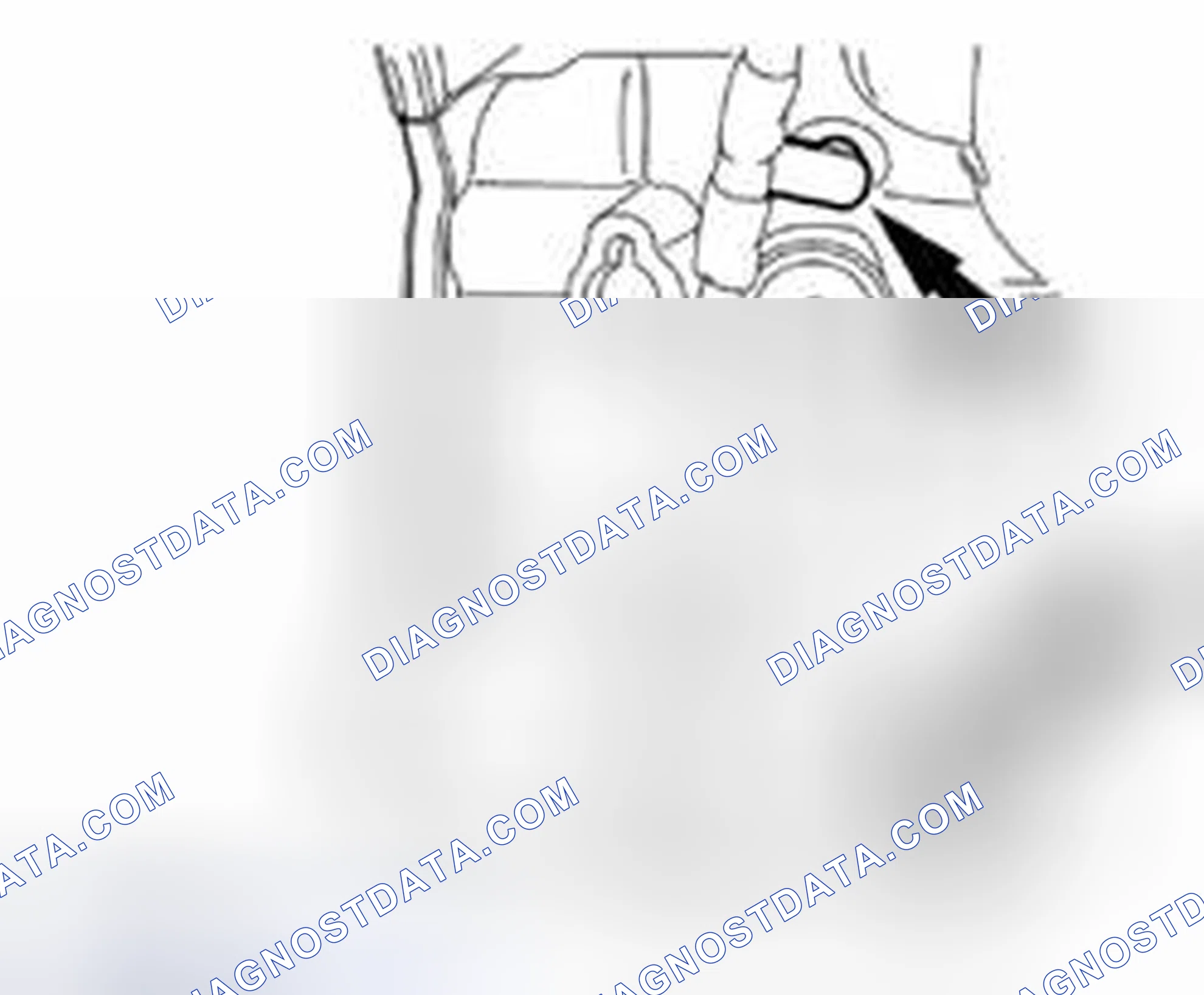 Scheme 935