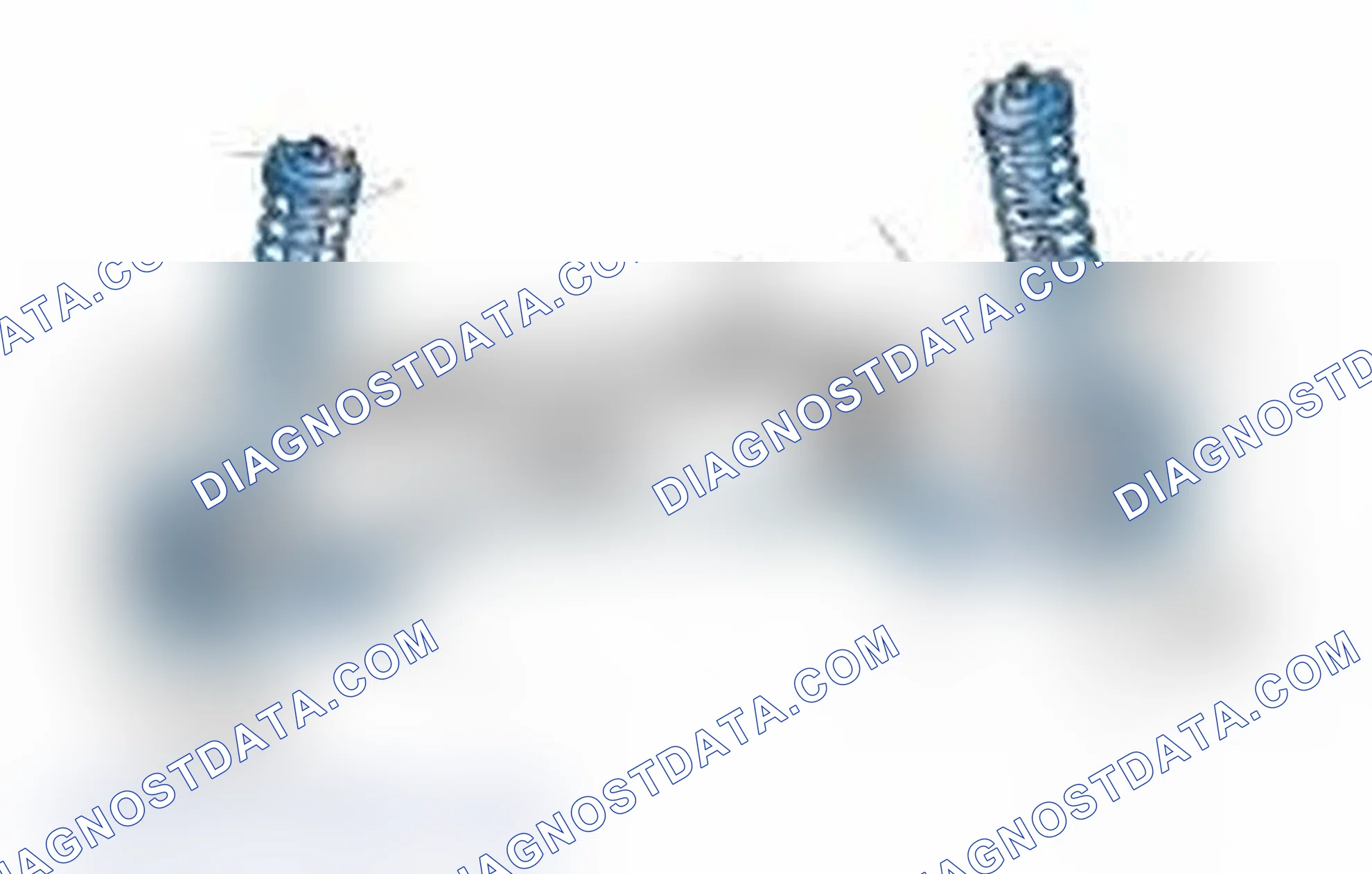 Scheme 25: Typical Front Suspension & Steering Components