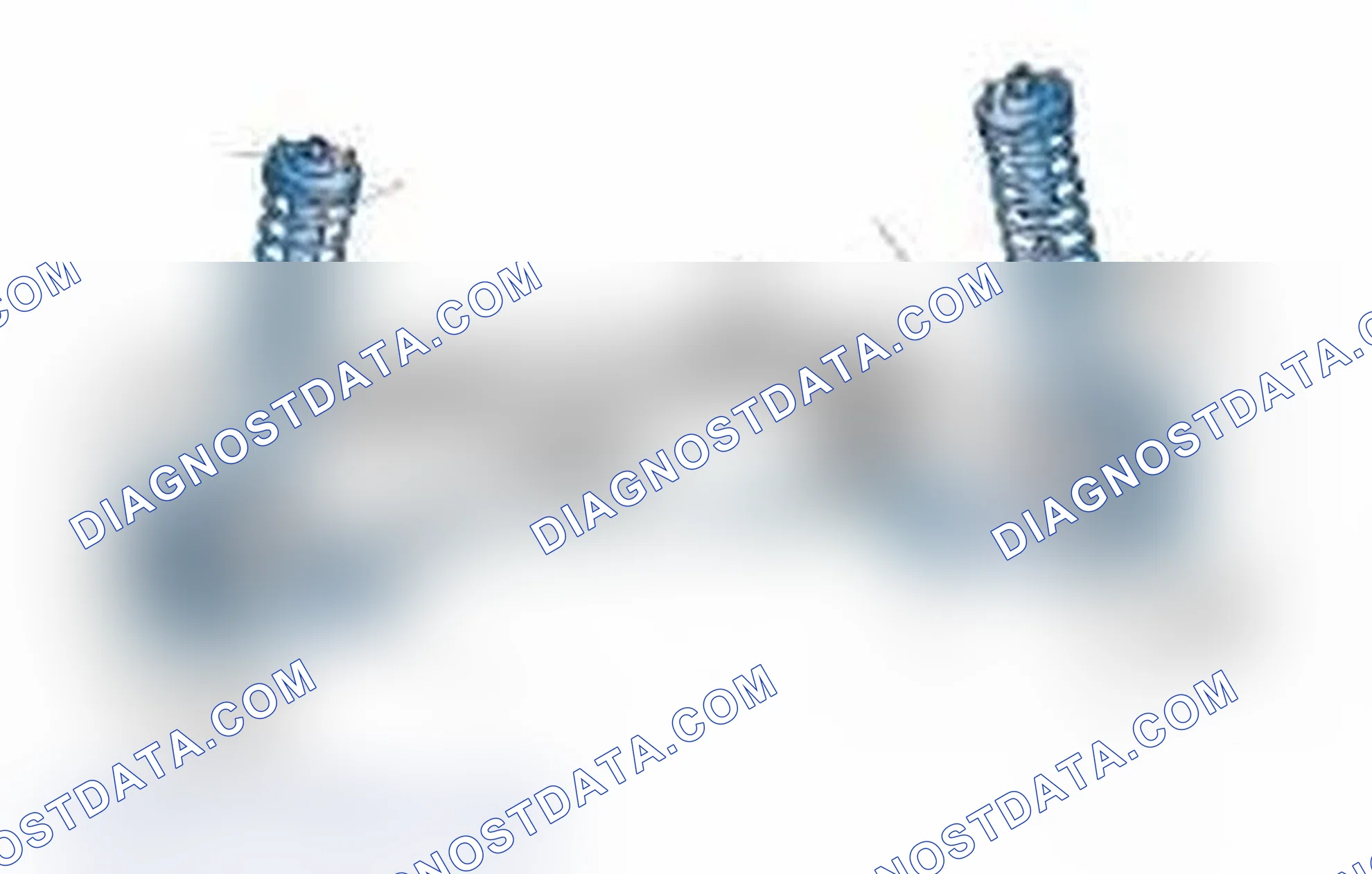 Scheme 25: Typical Front Suspension & Steering Components