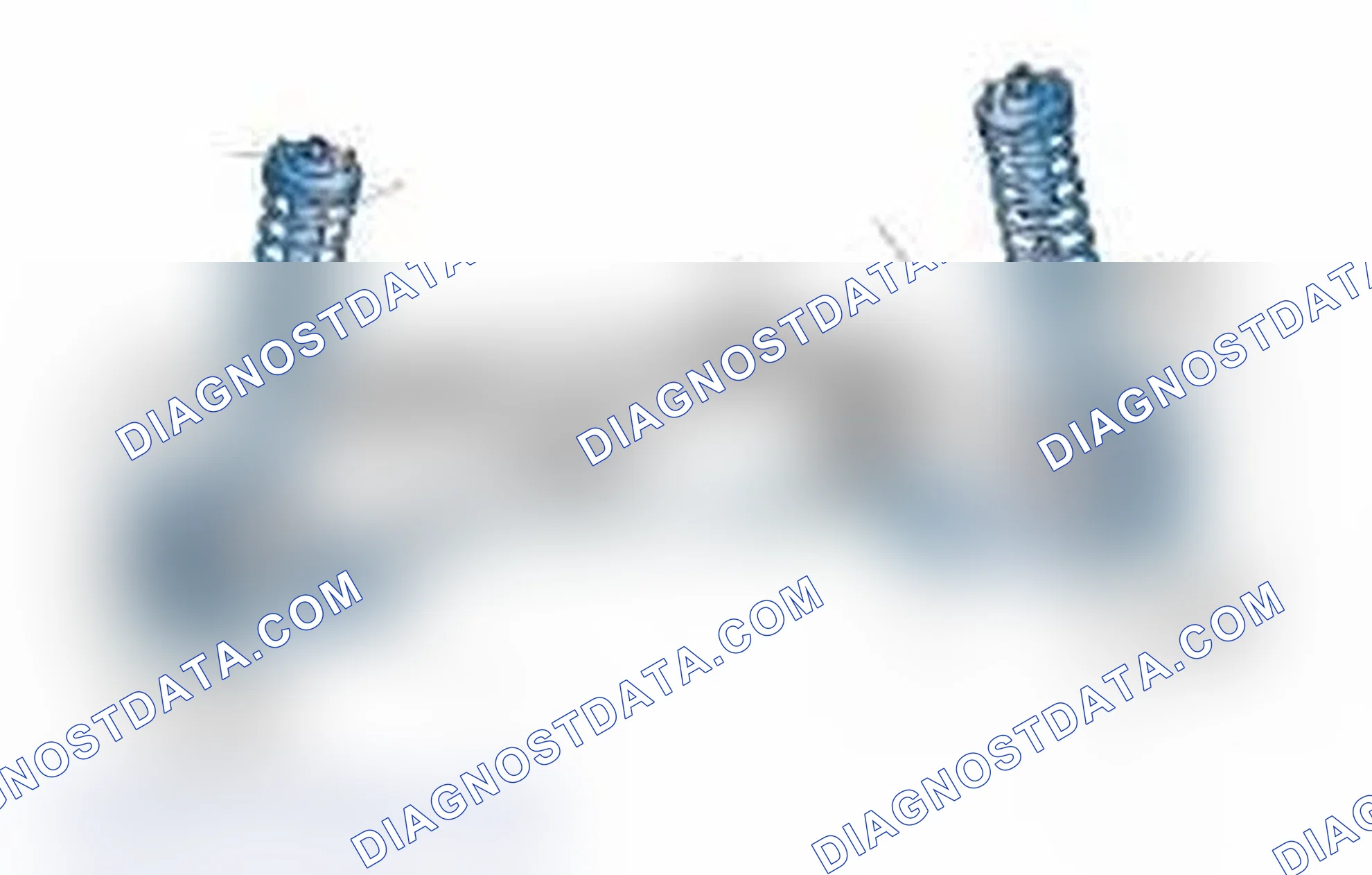 Scheme 25: Typical Front Suspension & Steering Components