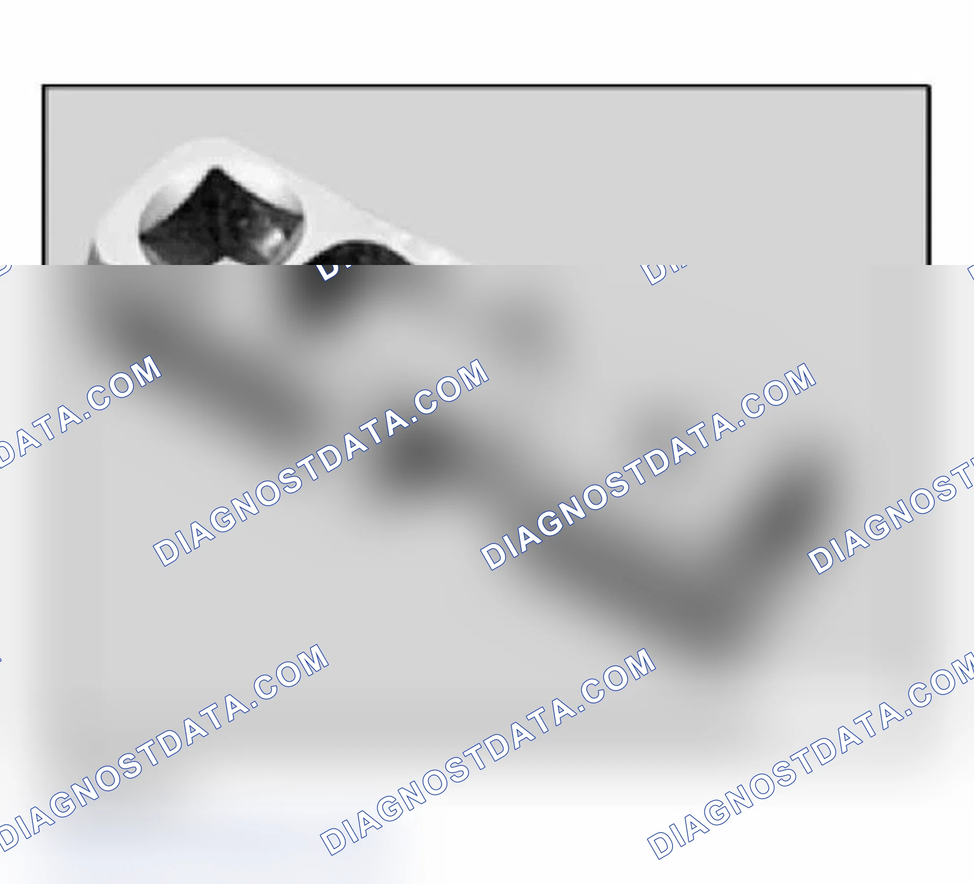 Scheme 44: 11 9 150 Special wrench