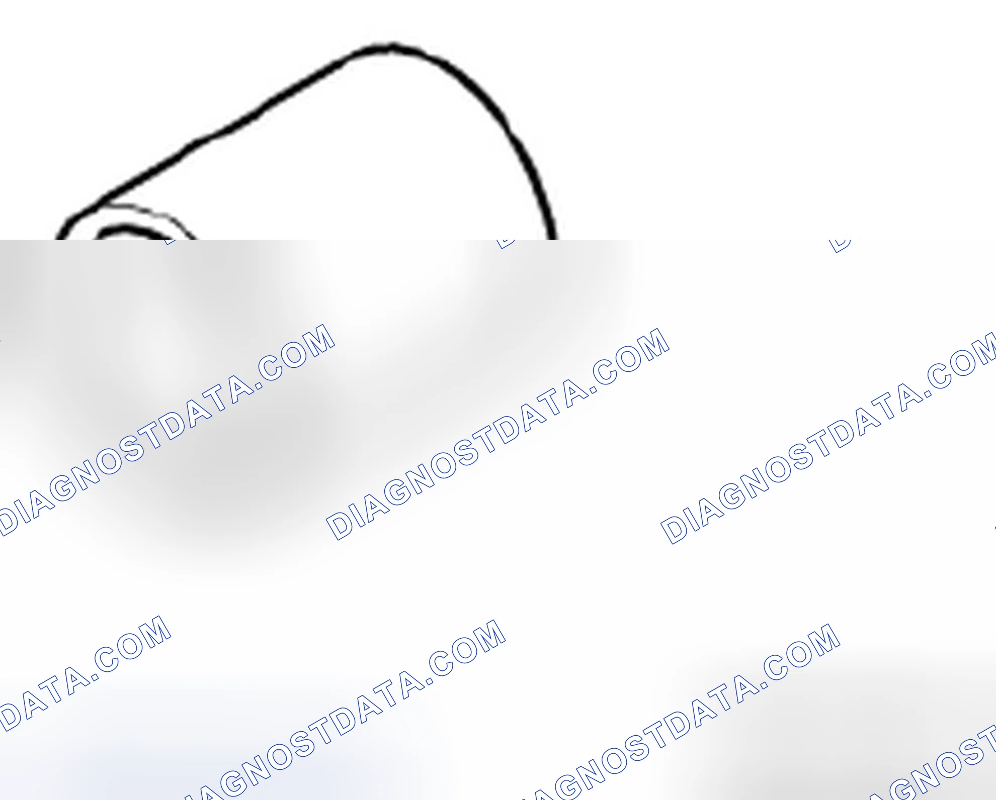 Scheme 323: 24 1 080 Bush (Aluminium)
