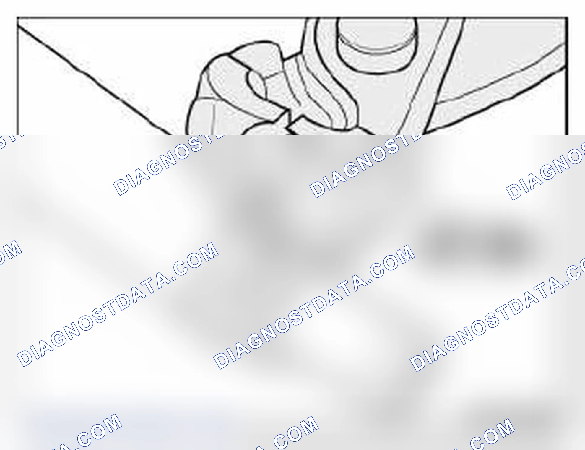 Scheme 168: 32 41... Instructions for removing and installing ear clips