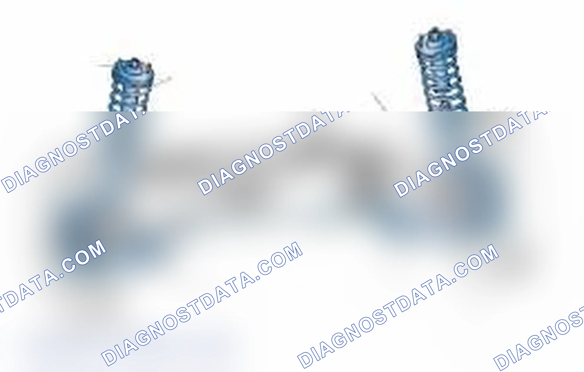 Scheme 25: Typical Front Suspension & Steering Components