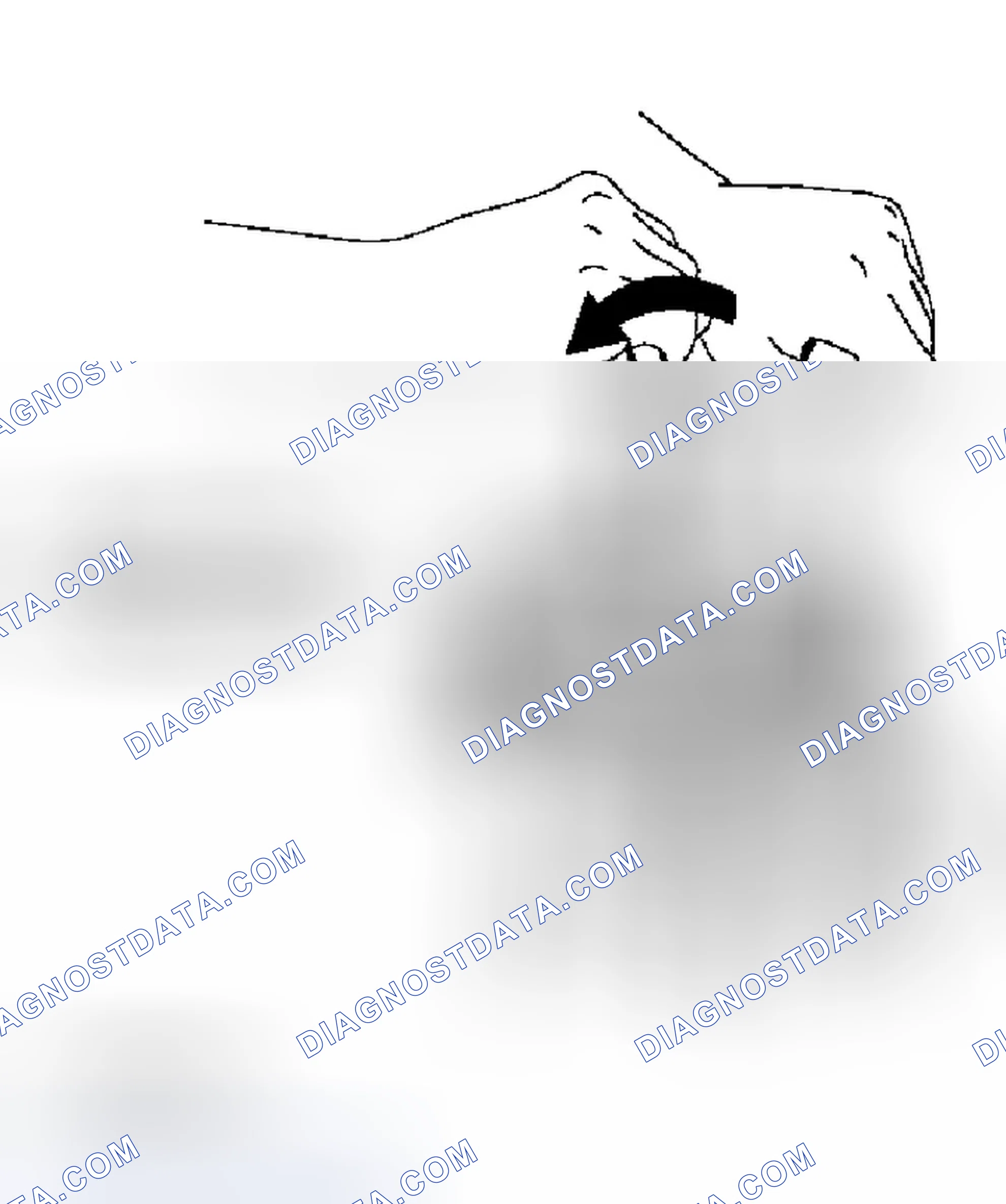 Scheme 119: REMOVAL
