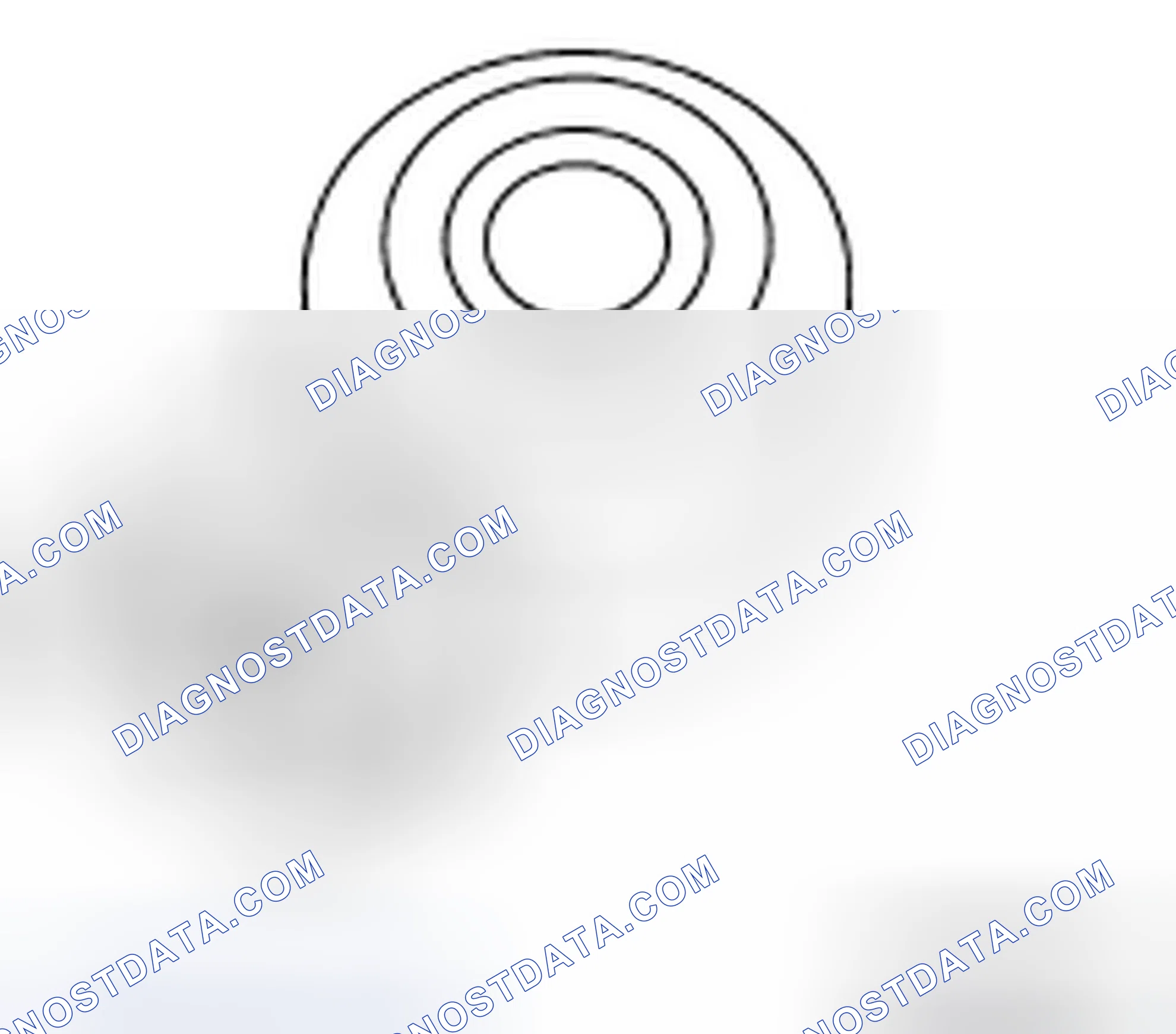 Scheme 78: Knock Sensor
