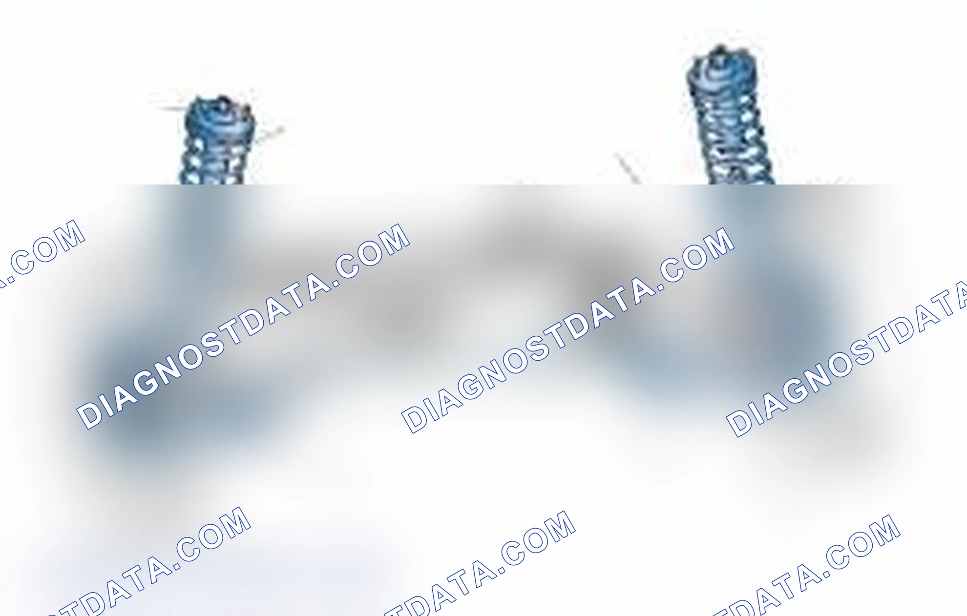 Scheme 25: Typical Front Suspension & Steering Components
