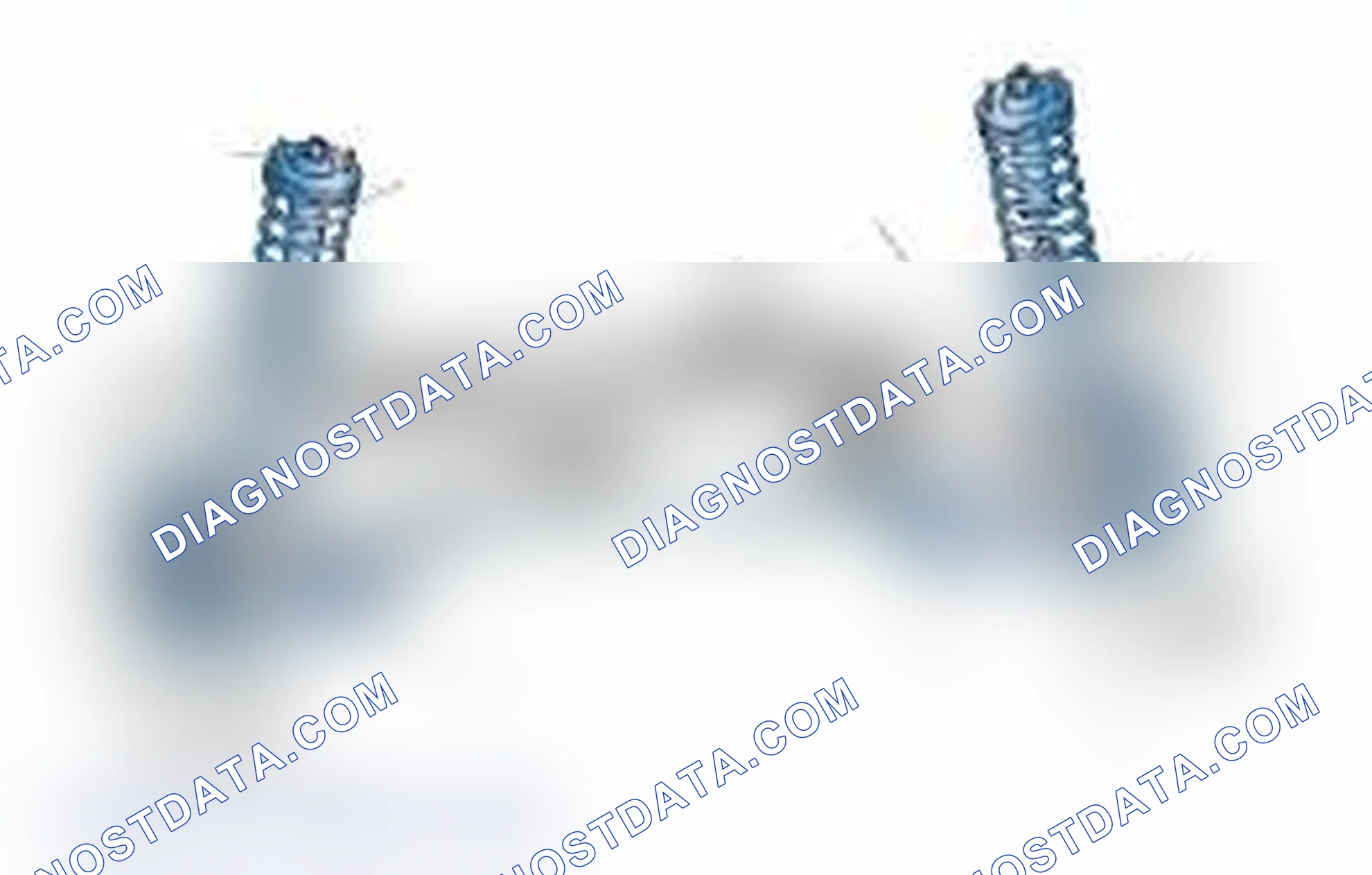 Scheme 25: Typical Front Suspension & Steering Components