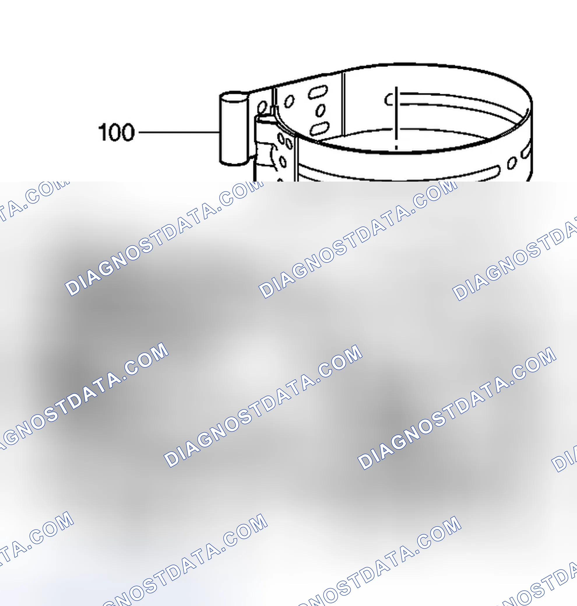 Scheme 321: Intermediate Fourth Band Removal