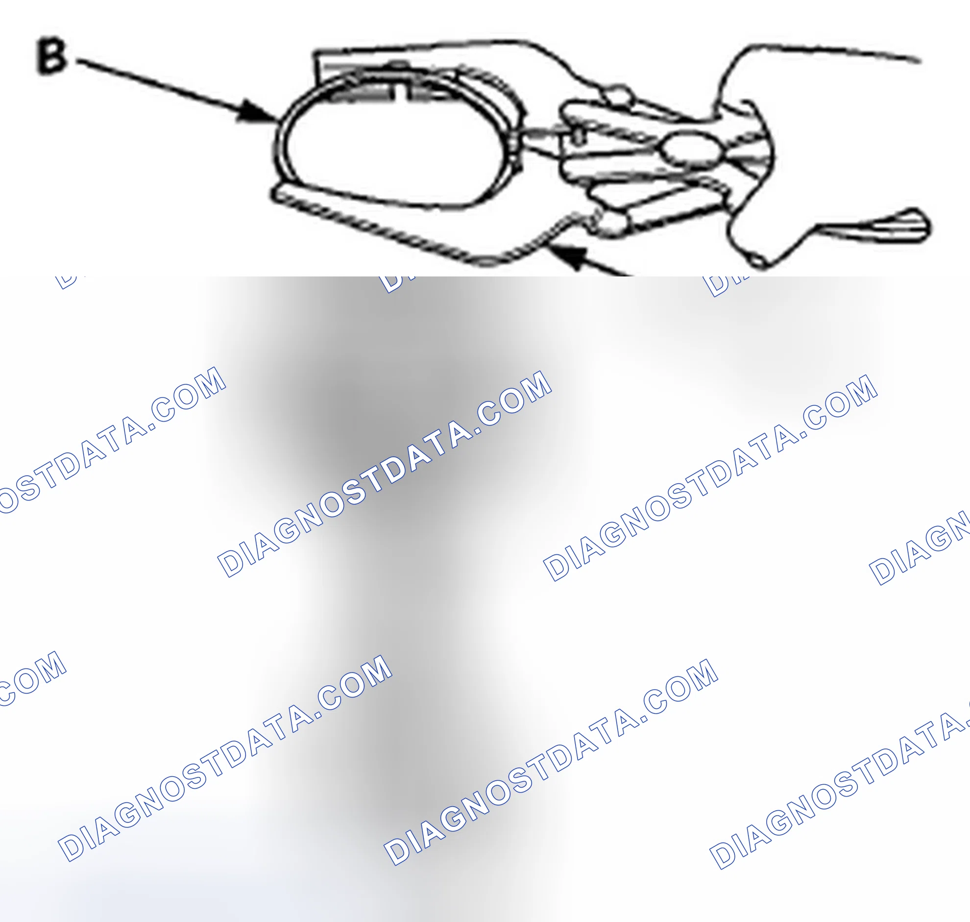 Scheme 636: Piston Ring Replacement