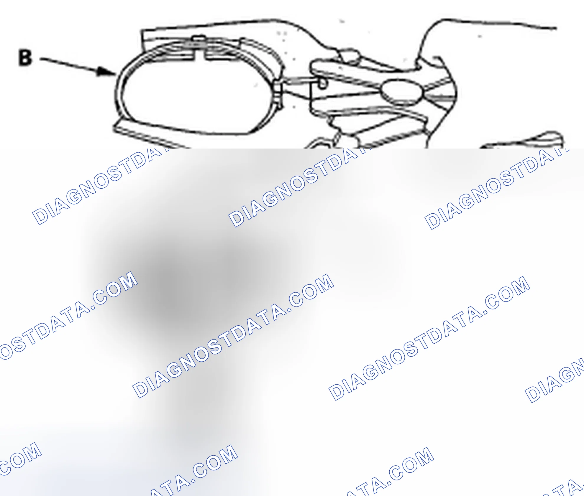 Scheme 712: Piston Ring Replacement