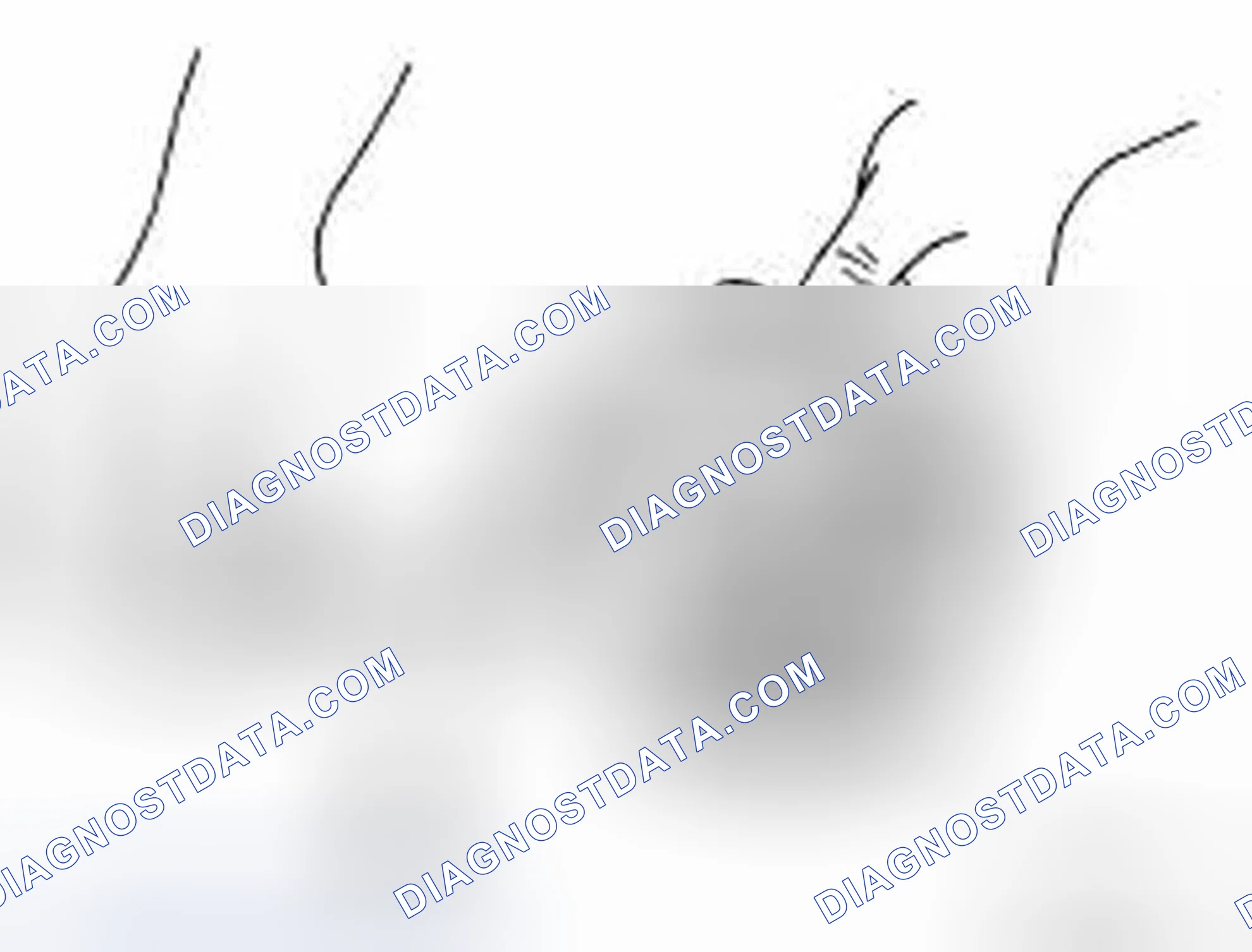 Scheme 226: Piston Skirt Diameter