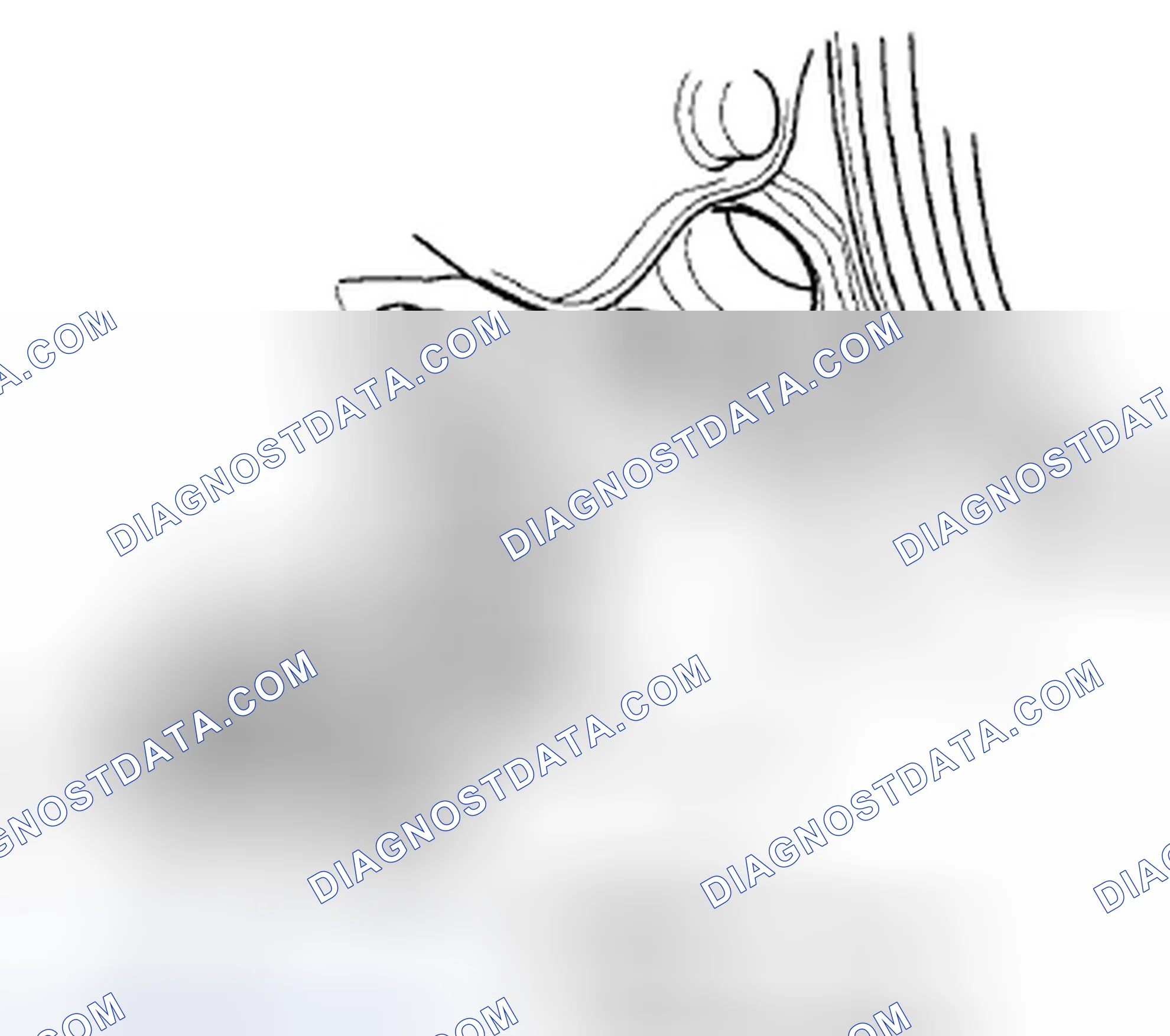 Scheme 209: CKP Sensor Replacement