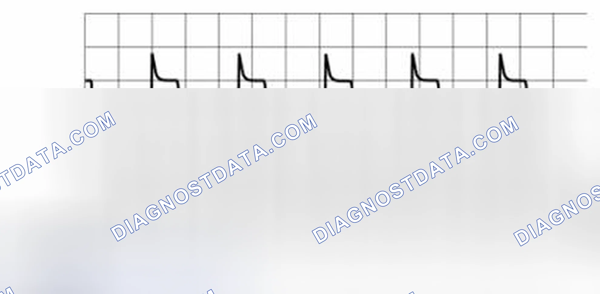 Scheme 5: BCM Pattern 3 (Generated Pulse)