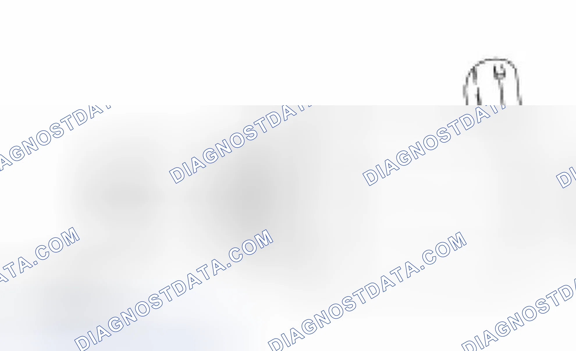 Scheme 158: Injection Pressure Regulator (IPR)