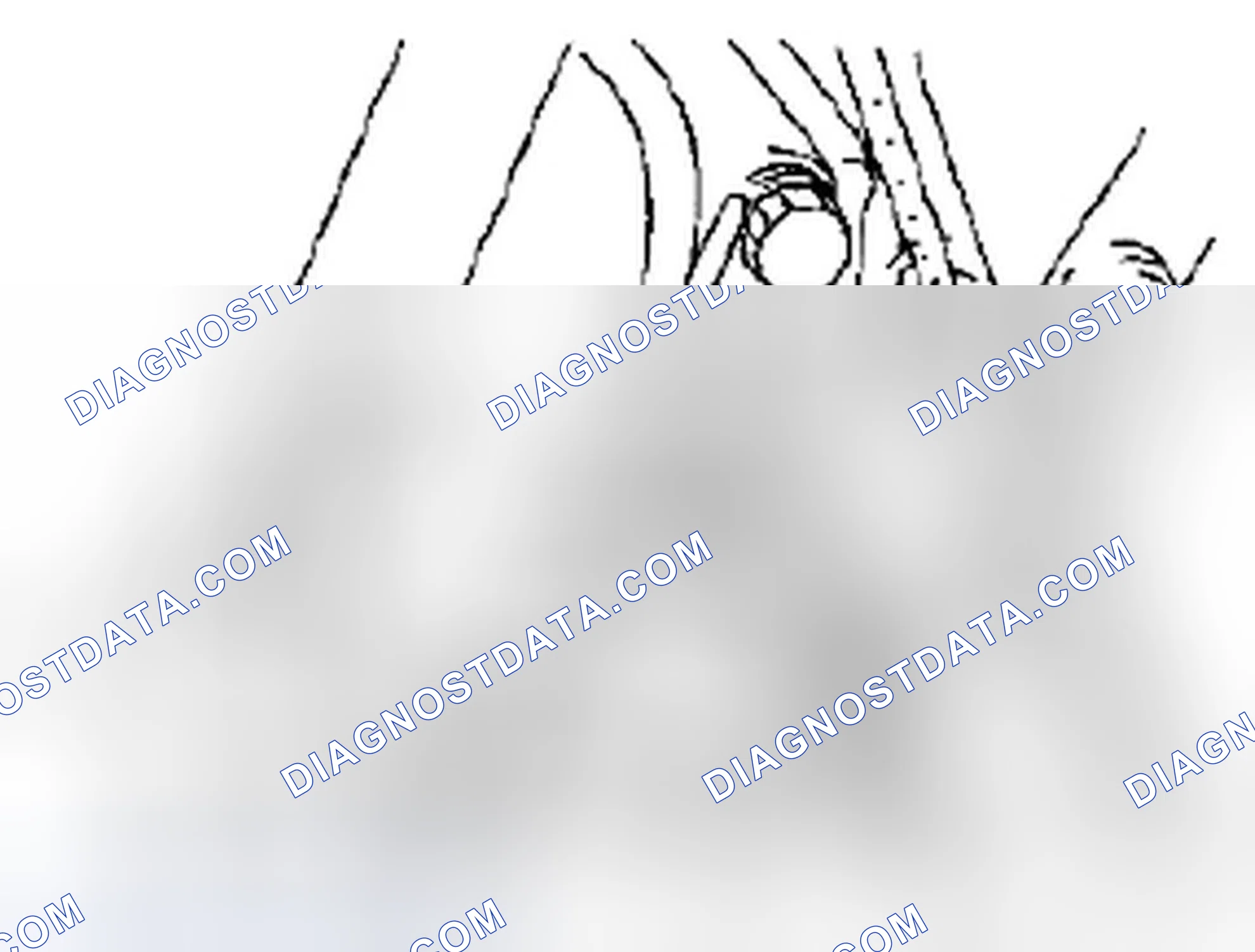 Scheme 178: Connecting rod