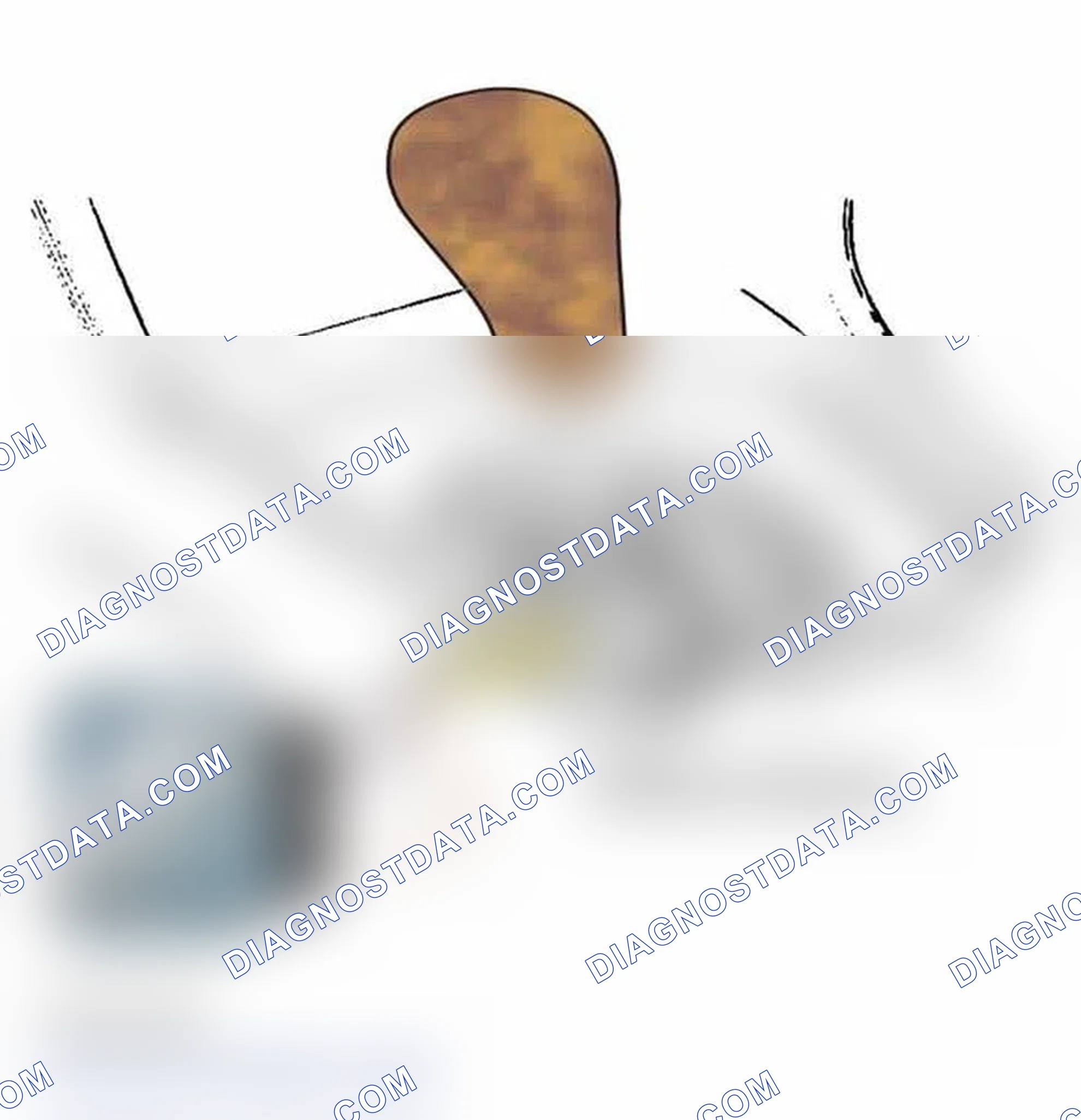 Scheme 170: SHIFT LOCK