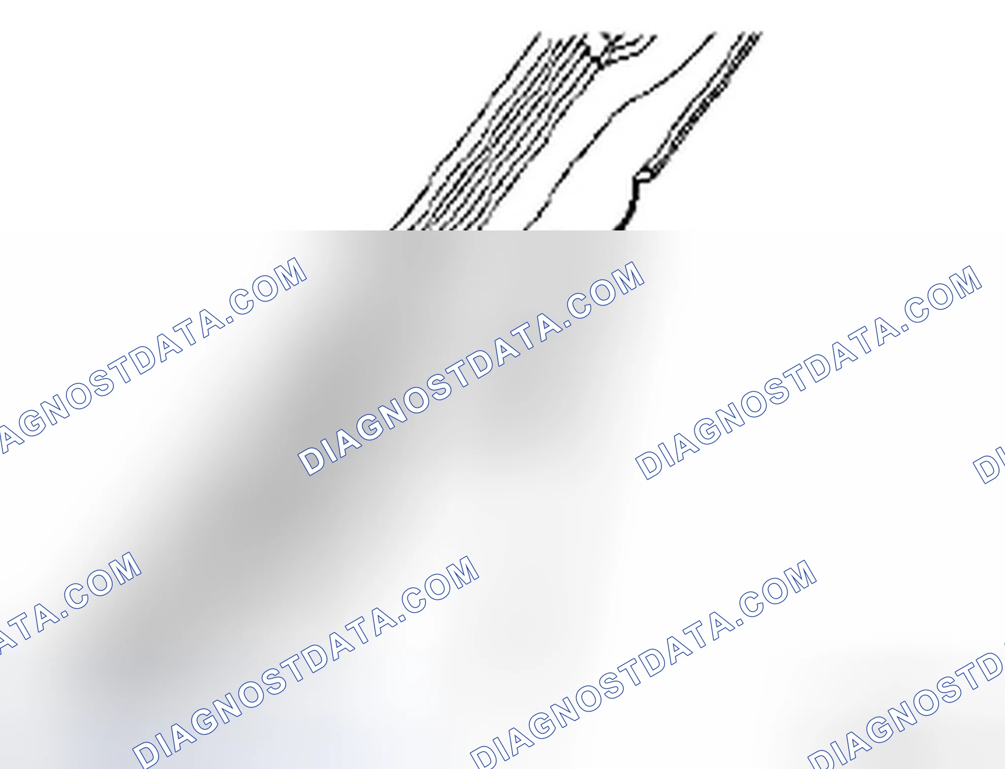 Scheme 8: Removal