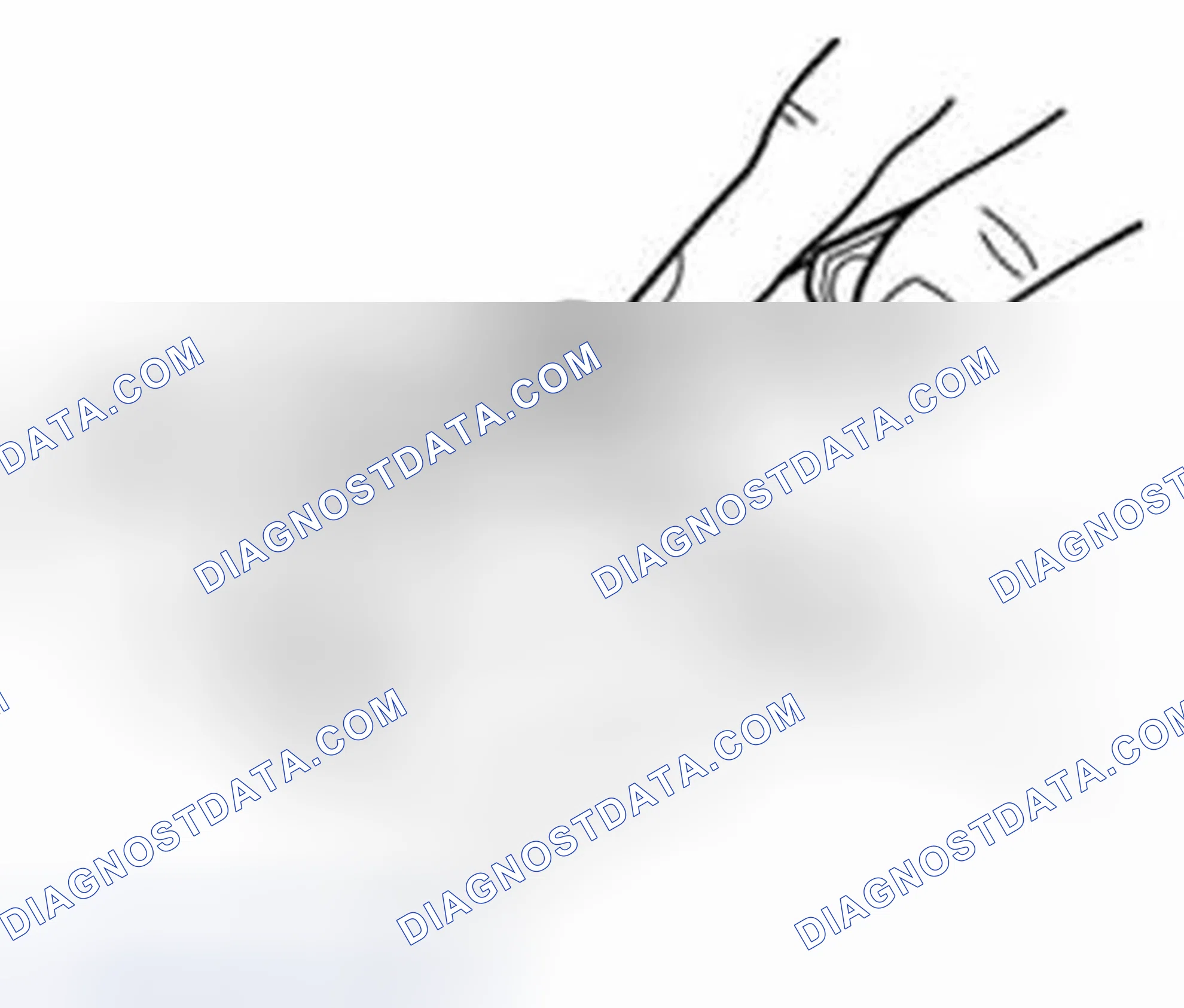 Scheme 191: Big-end side clearance