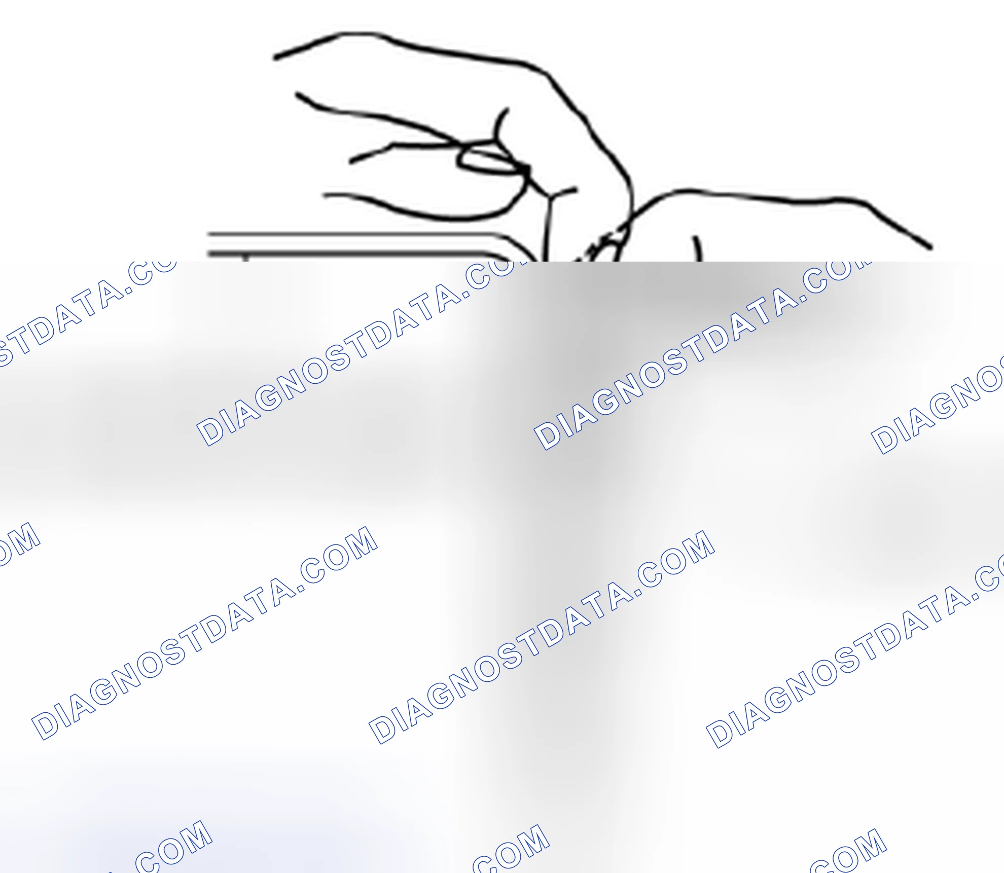 Scheme 59: Pulling Battery Clips