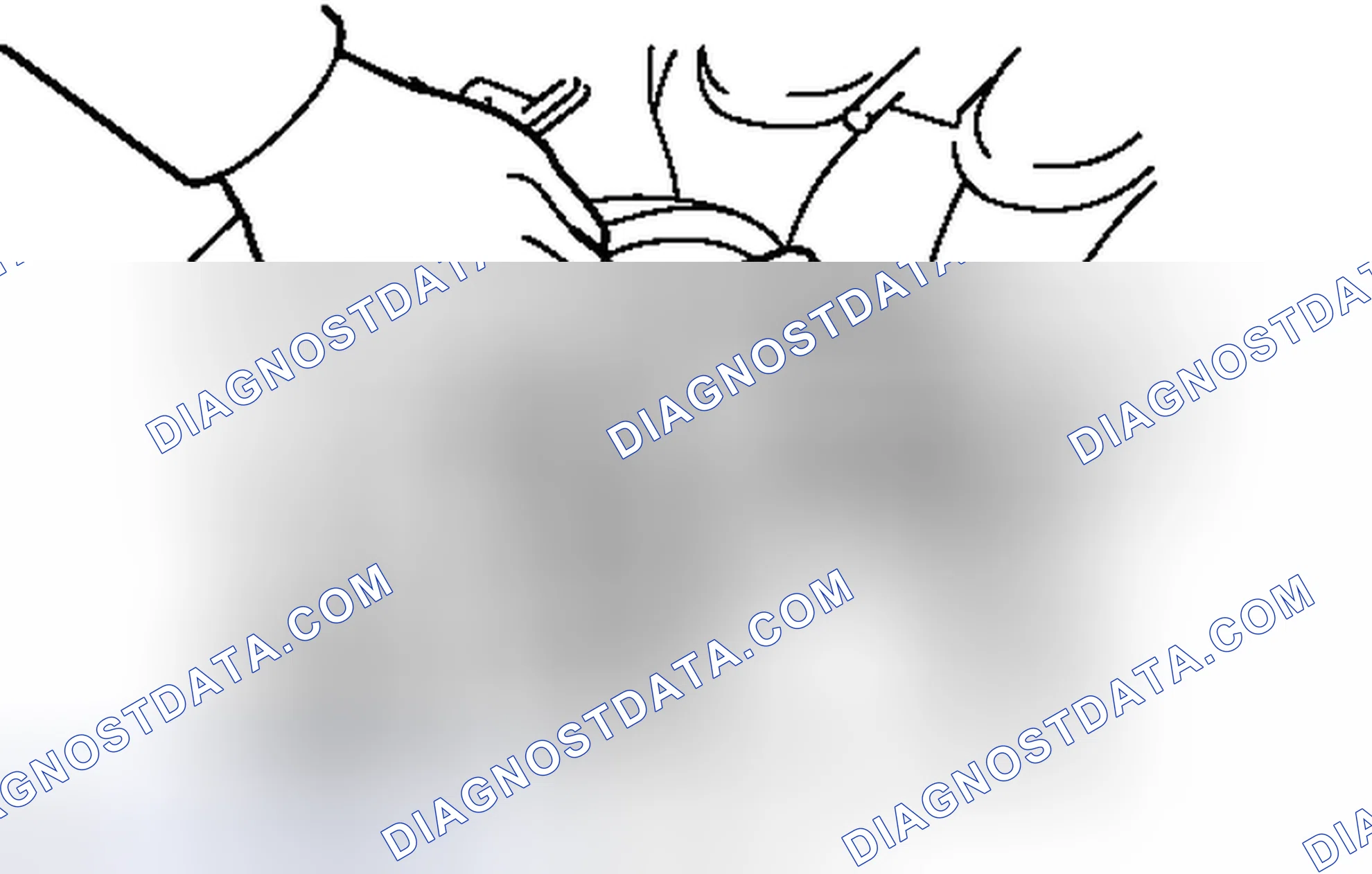 Scheme 4: ON-VEHICLE INSPECTION