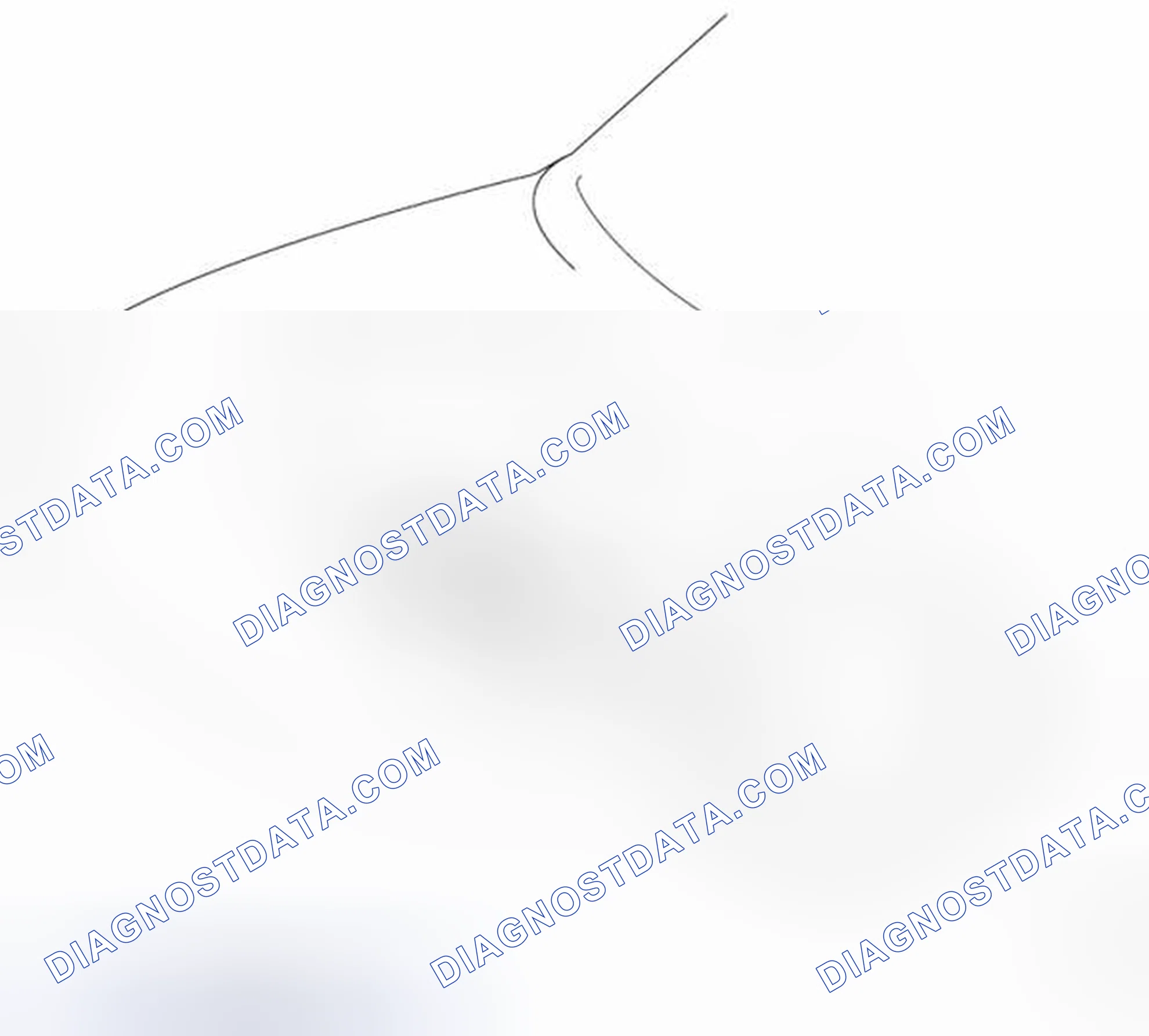 Scheme 30: Engine Mounting