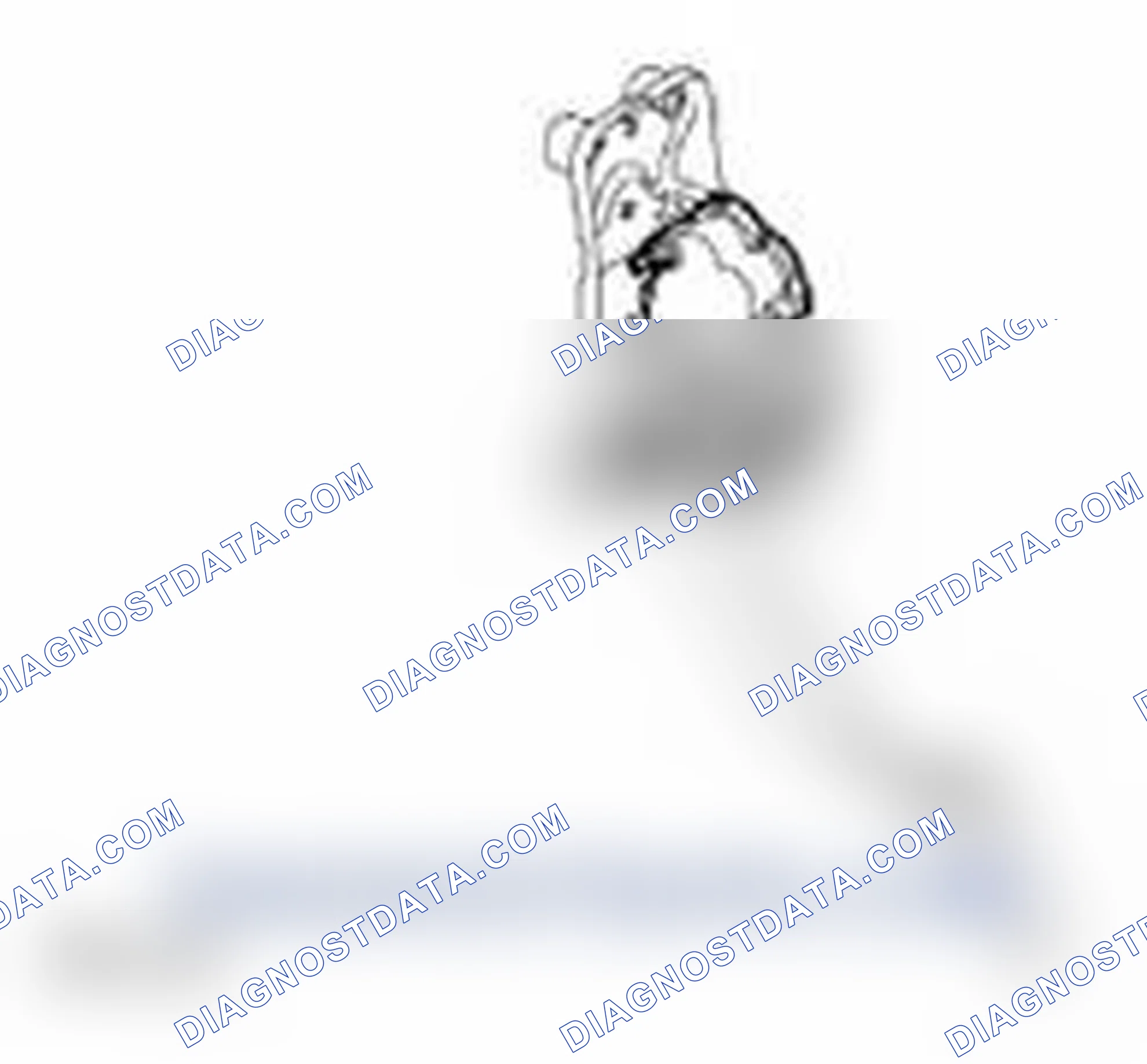 Scheme 26: ACCELERATOR PEDAL POSITION (APP) SENSOR