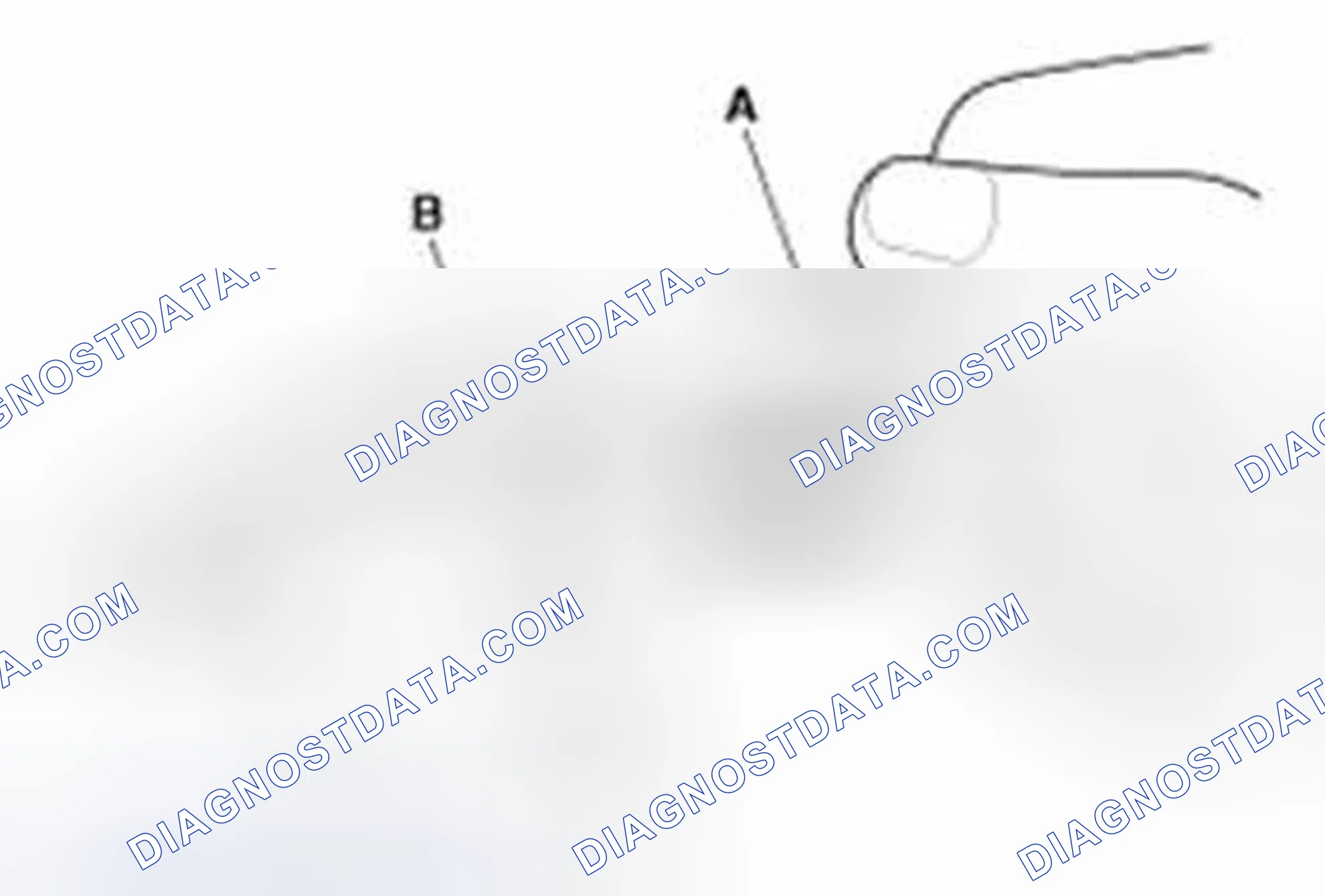 Scheme 170: Inspection