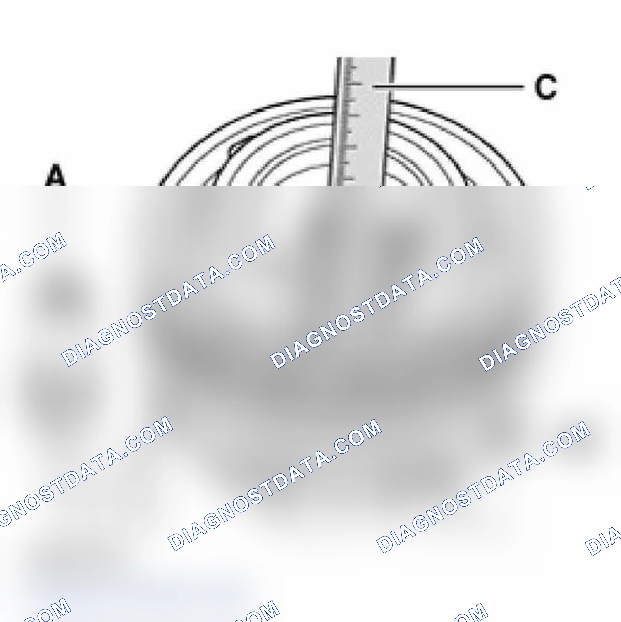 Scheme 18: Checking and adjusting gap