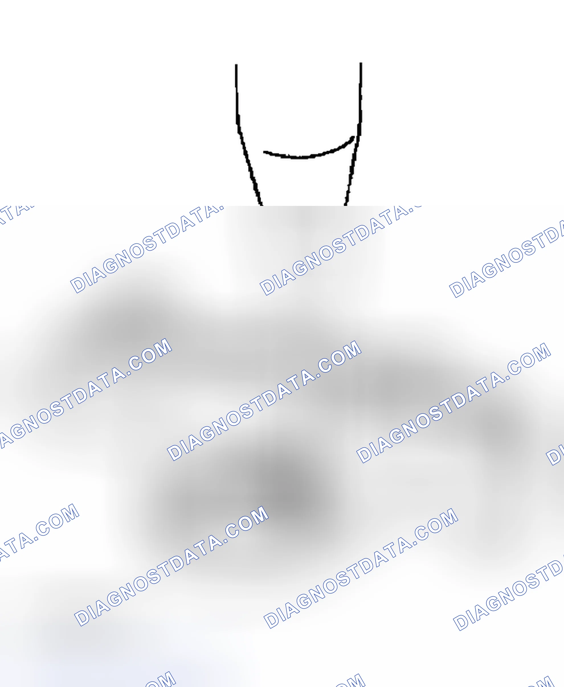 Scheme 121: CAMSHAFT OIL SEAL HOUSING DISASSEMBLY NOTE