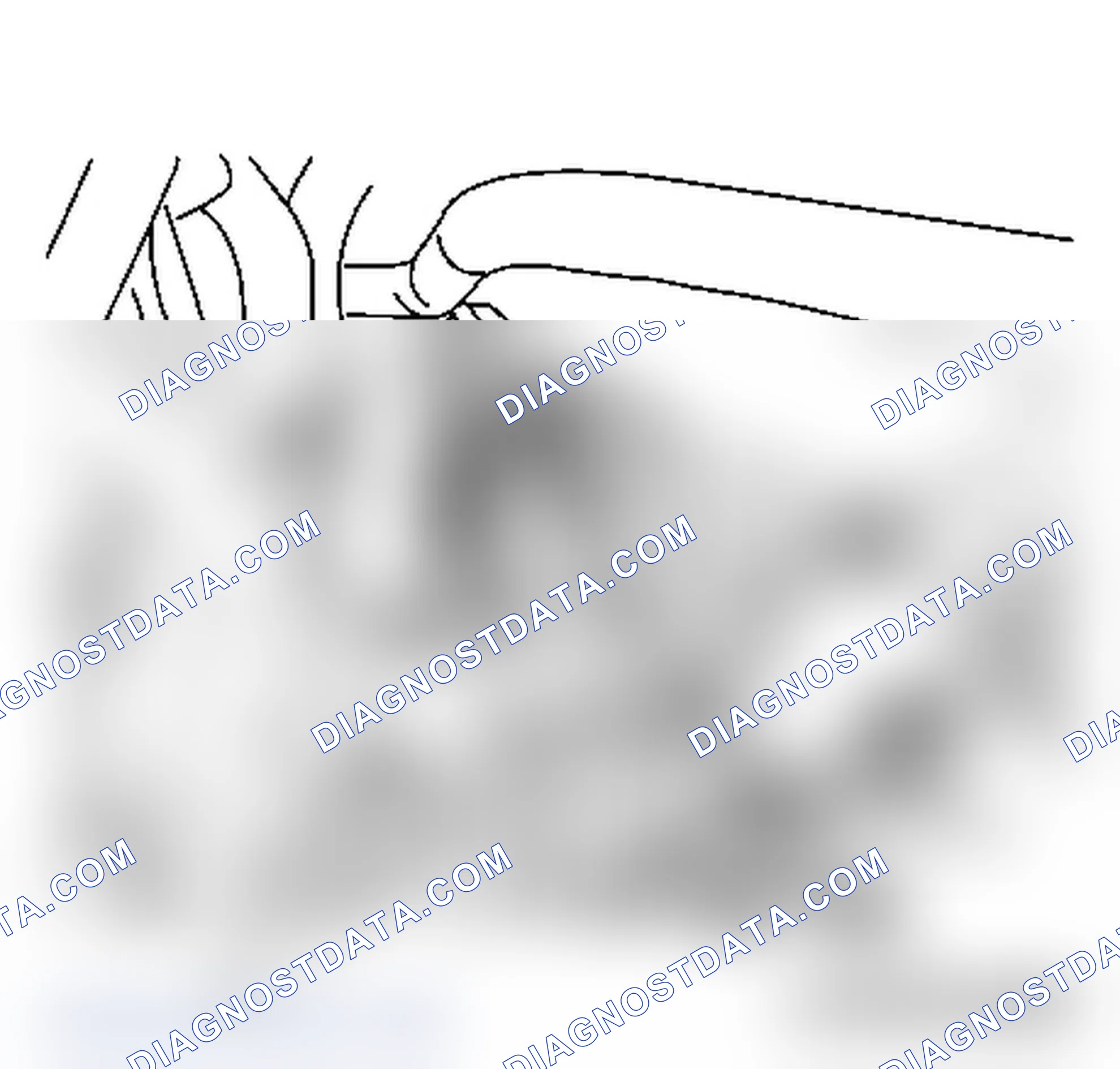 How to Remove and Install the Engine