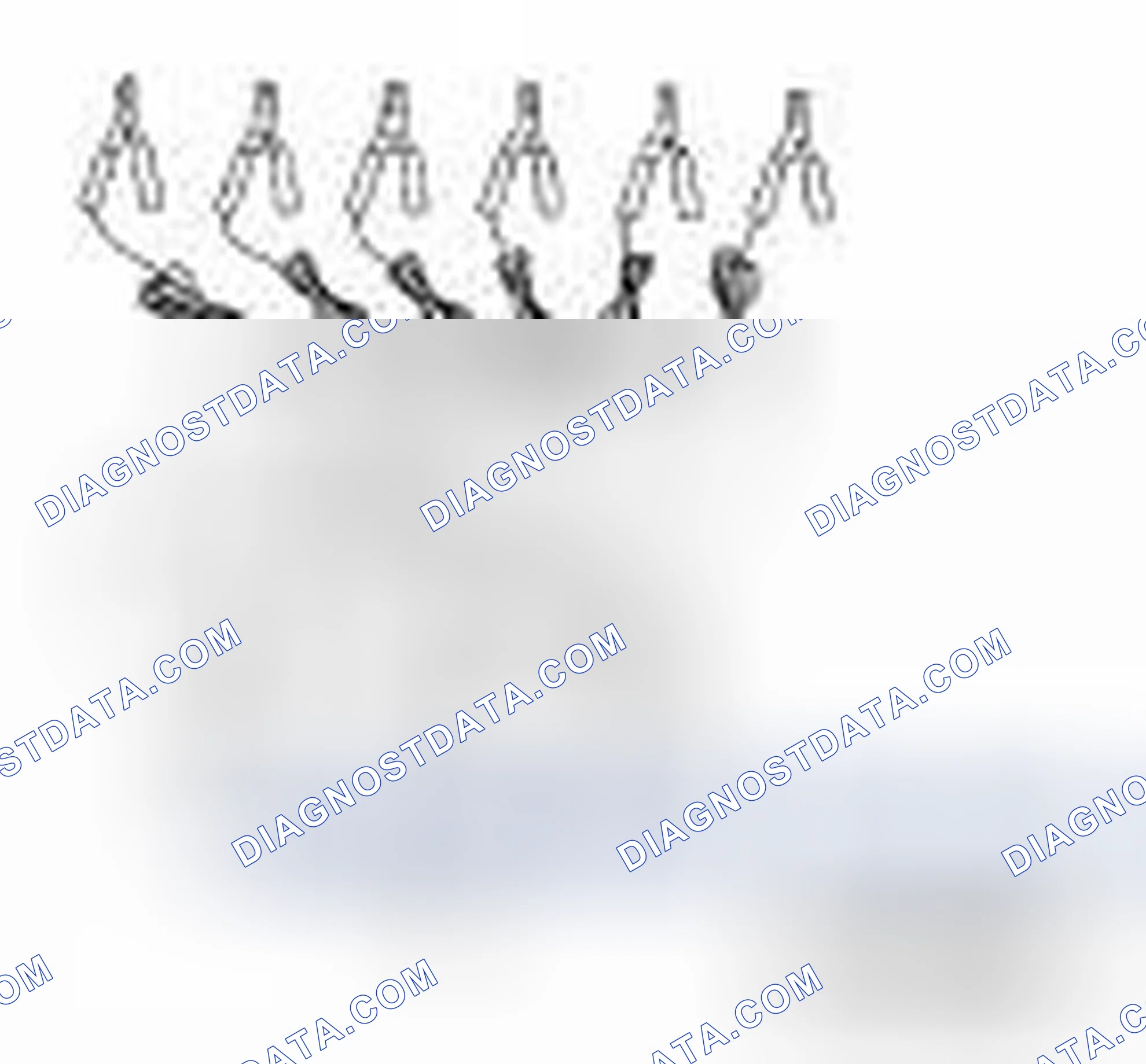 Scheme 214: Special Service Tool